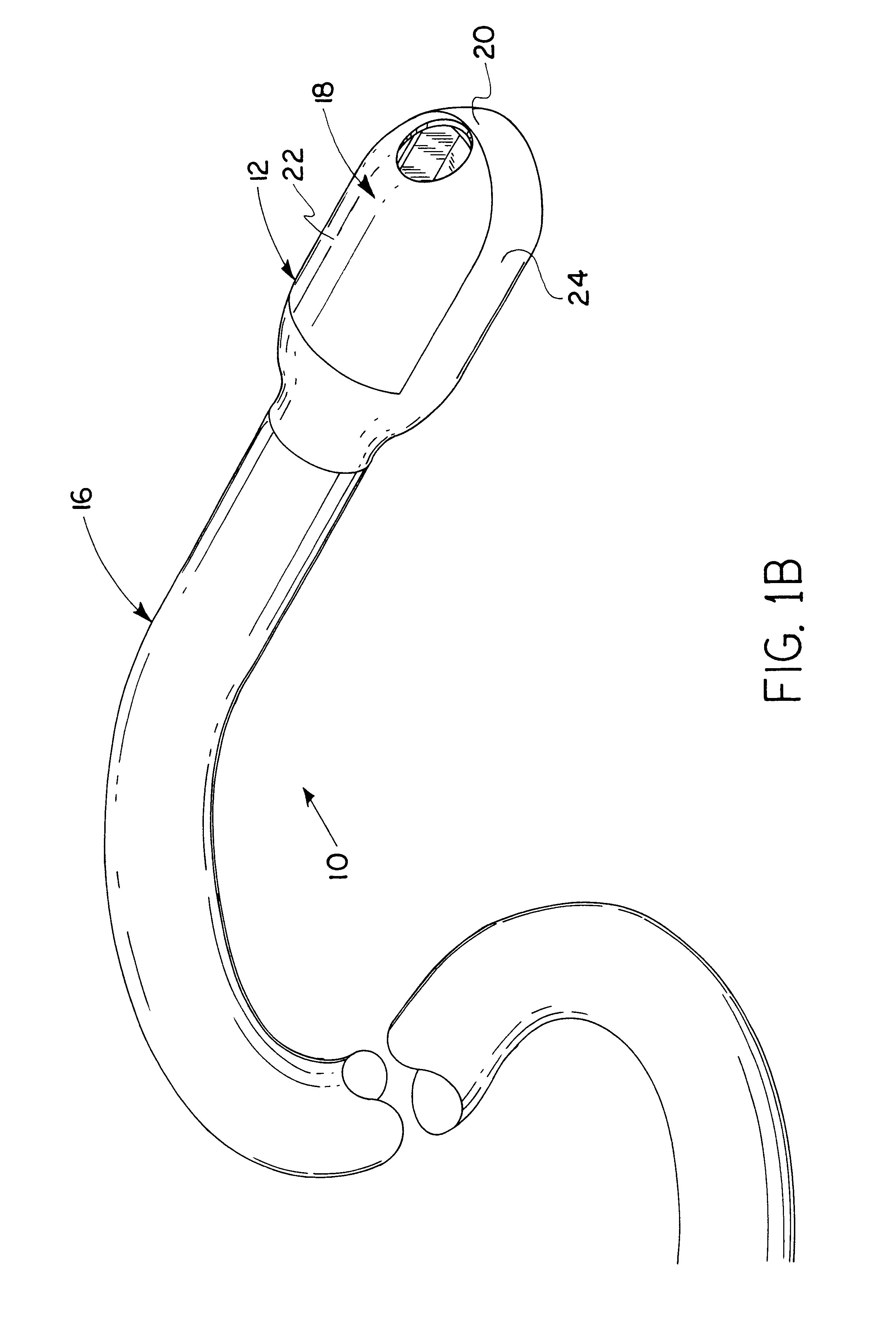 Surgical apparatus and method