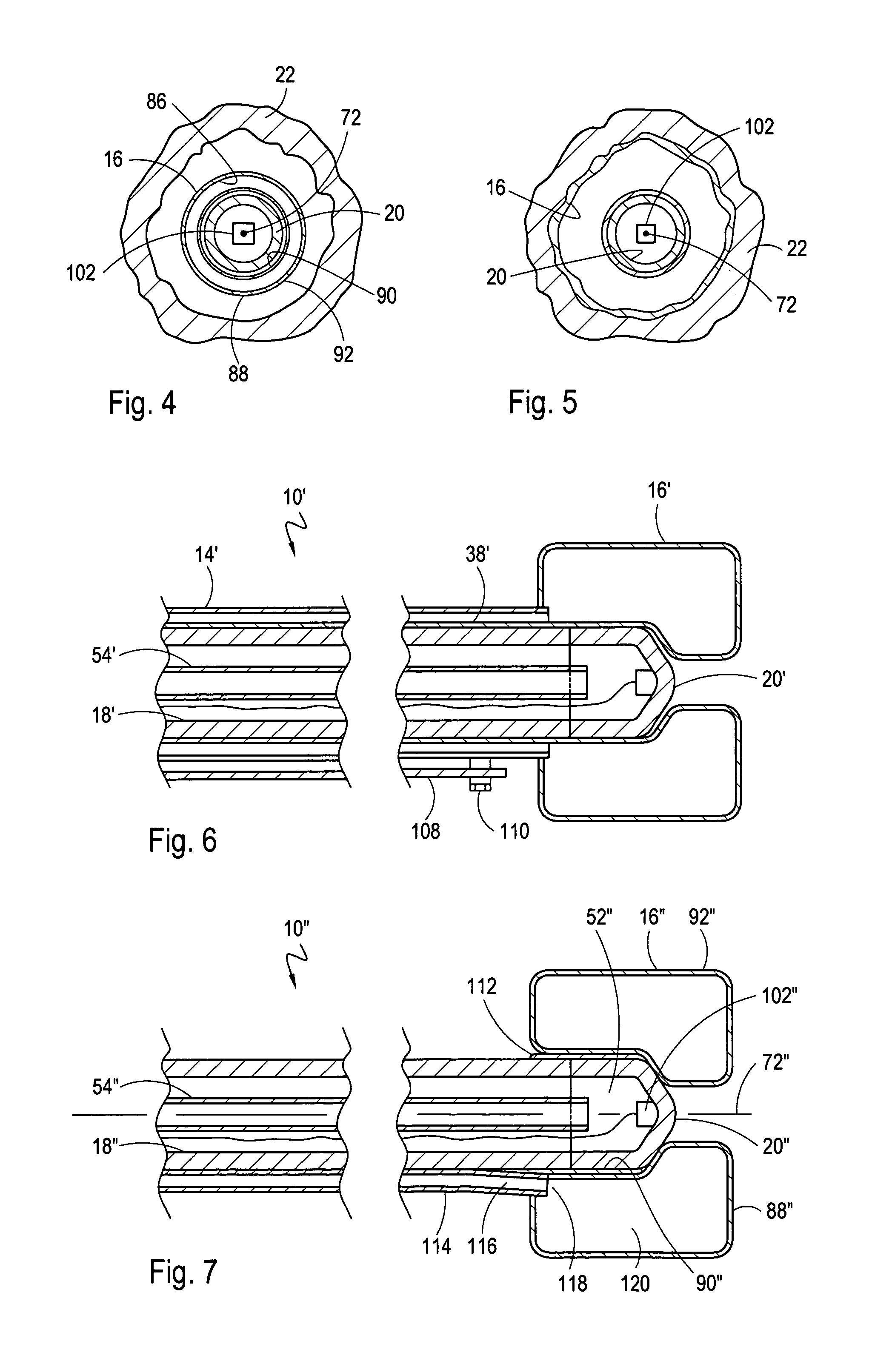 Catheter system for performing a single step cryoablation