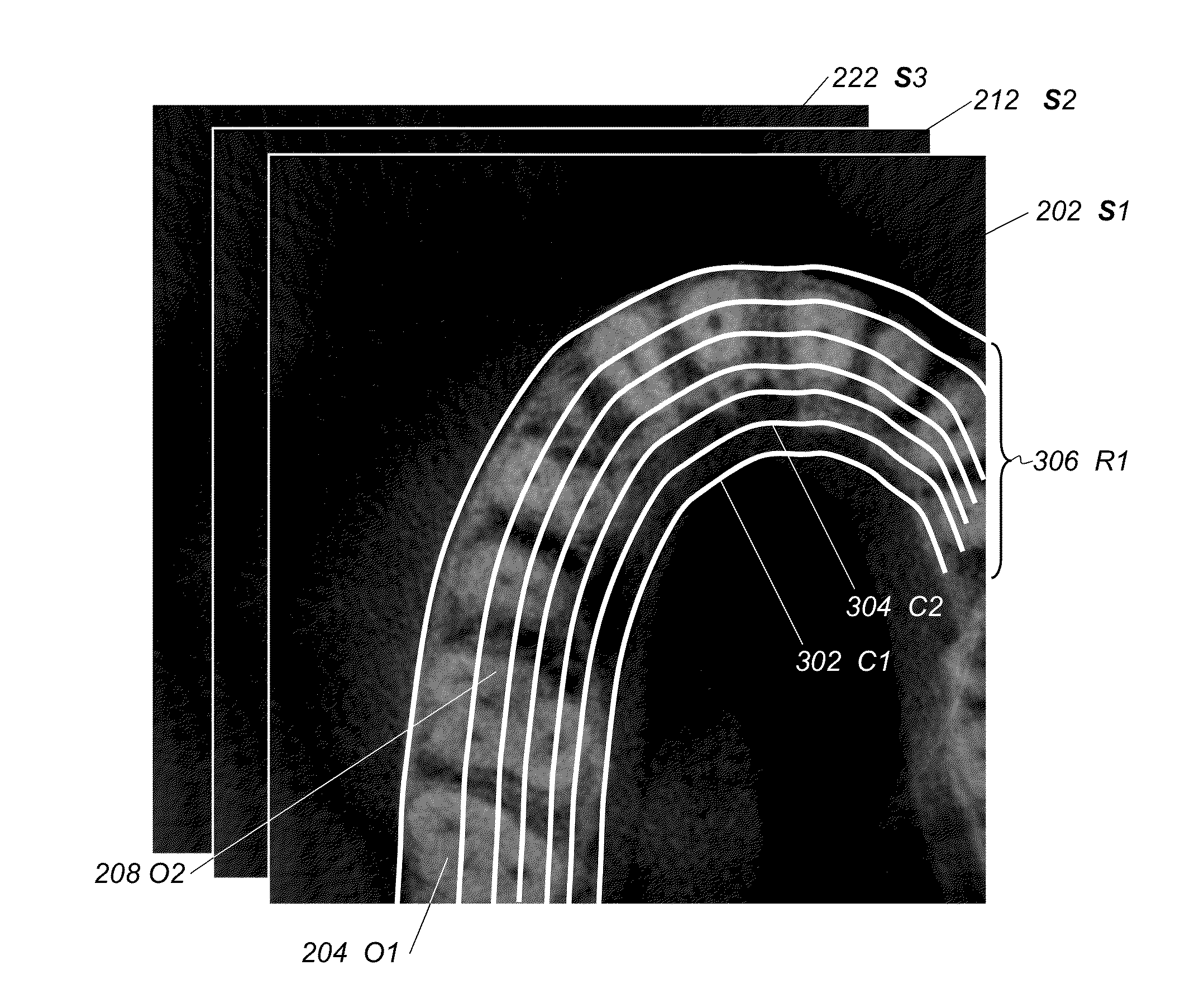 Method and system for tooth segmentation in dental images