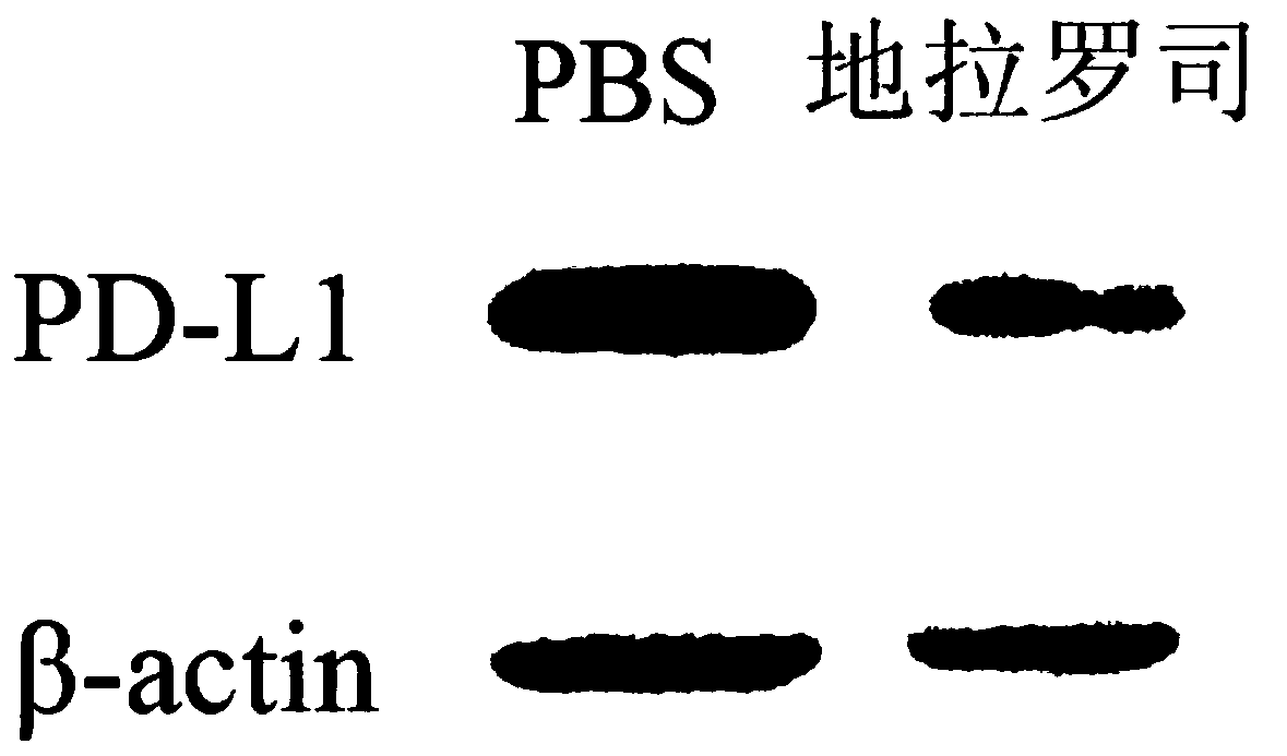 Iron ion chelating agent and application of medicinal salt of chelating agent