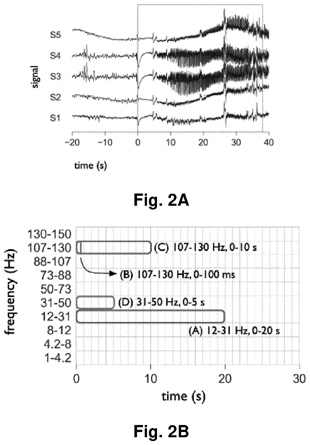 A computer implemented method and computer program products for identifying time-frequency features of physiological events