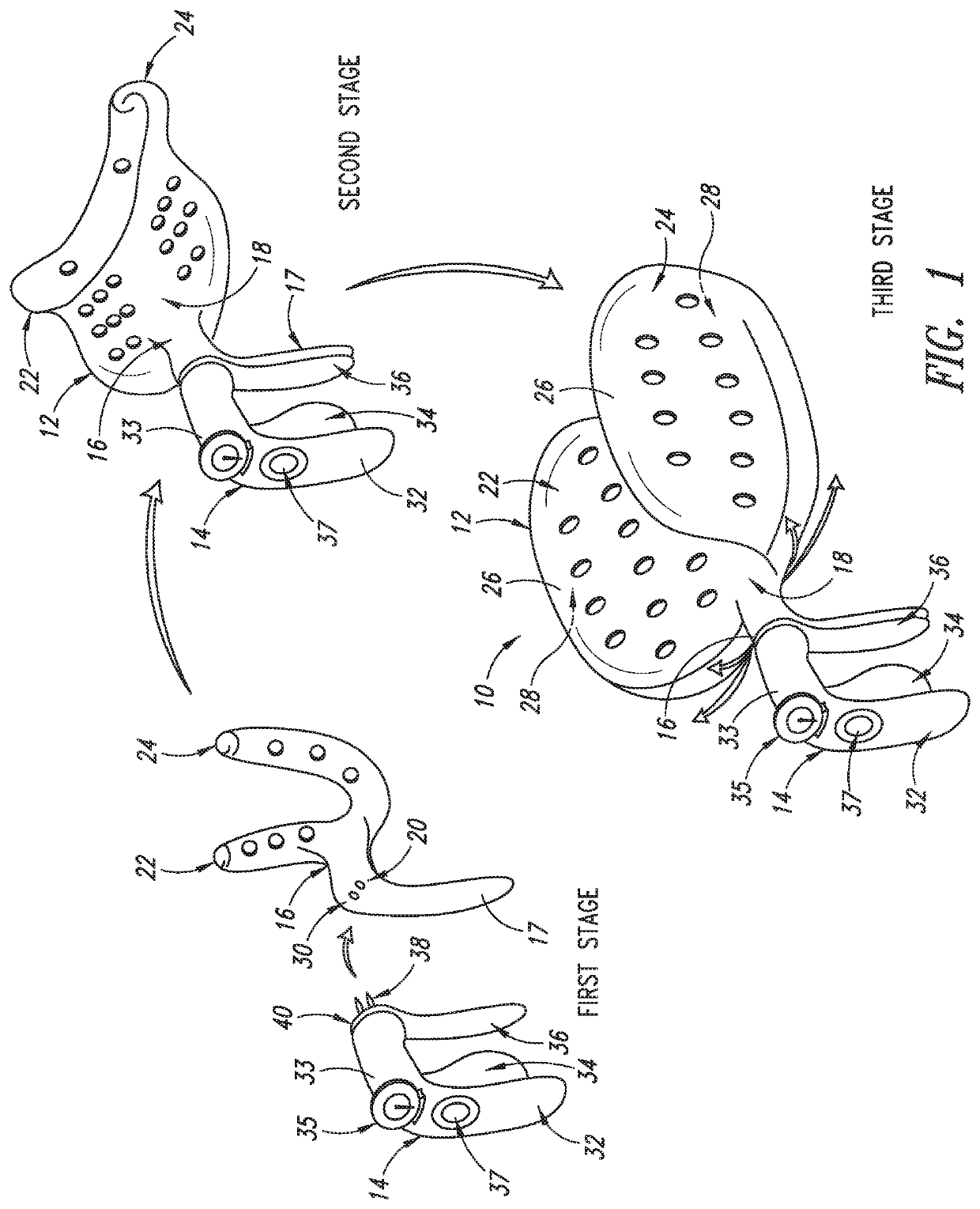 Apparatus to protect the pelvic floor during vaginal childbirth