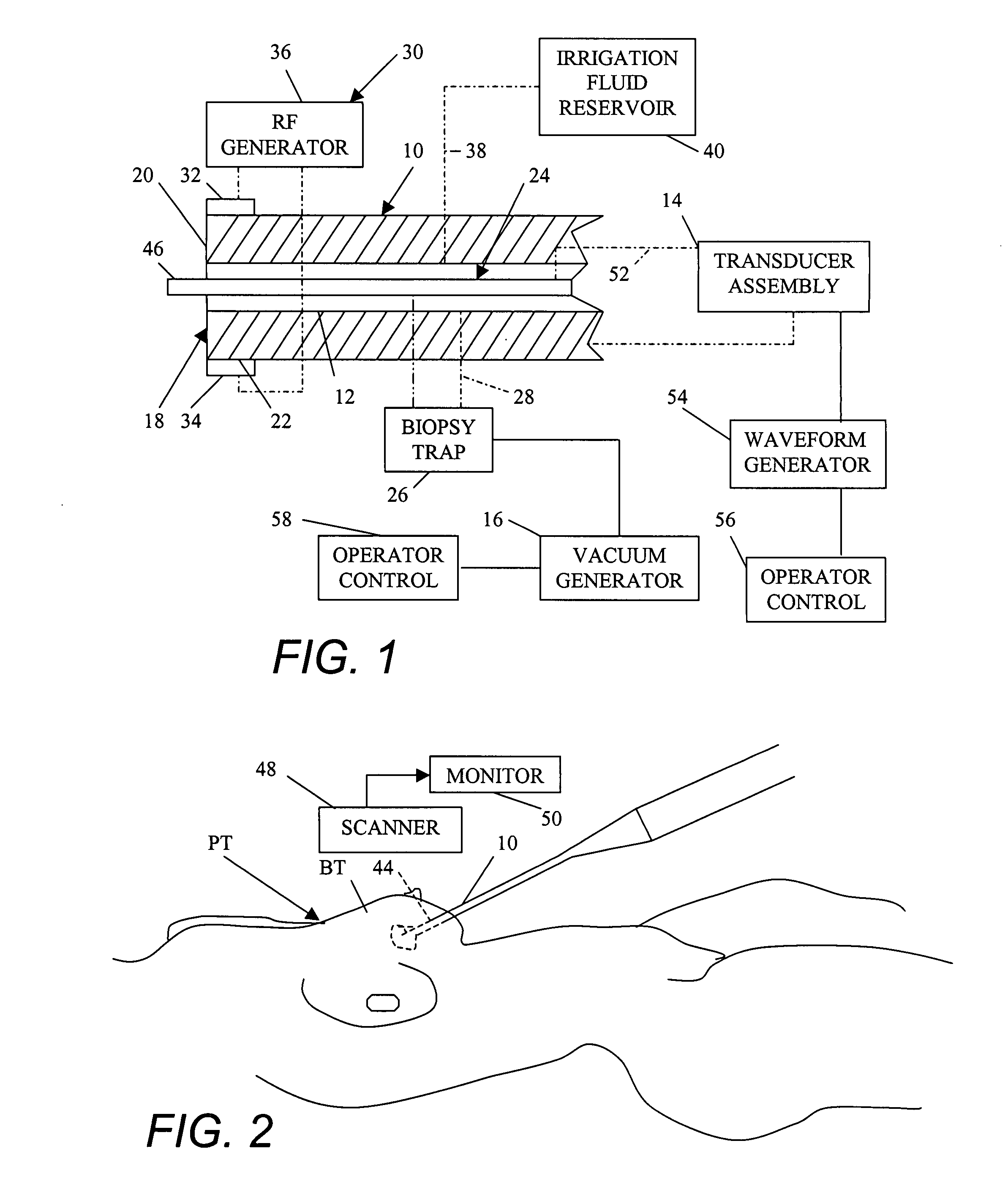 Treatment of breast disease with vibrating device