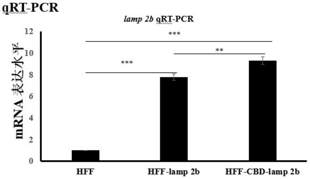 Enrichment method of exosome in extracellular matrix, ECM biological material rich in exosome and application