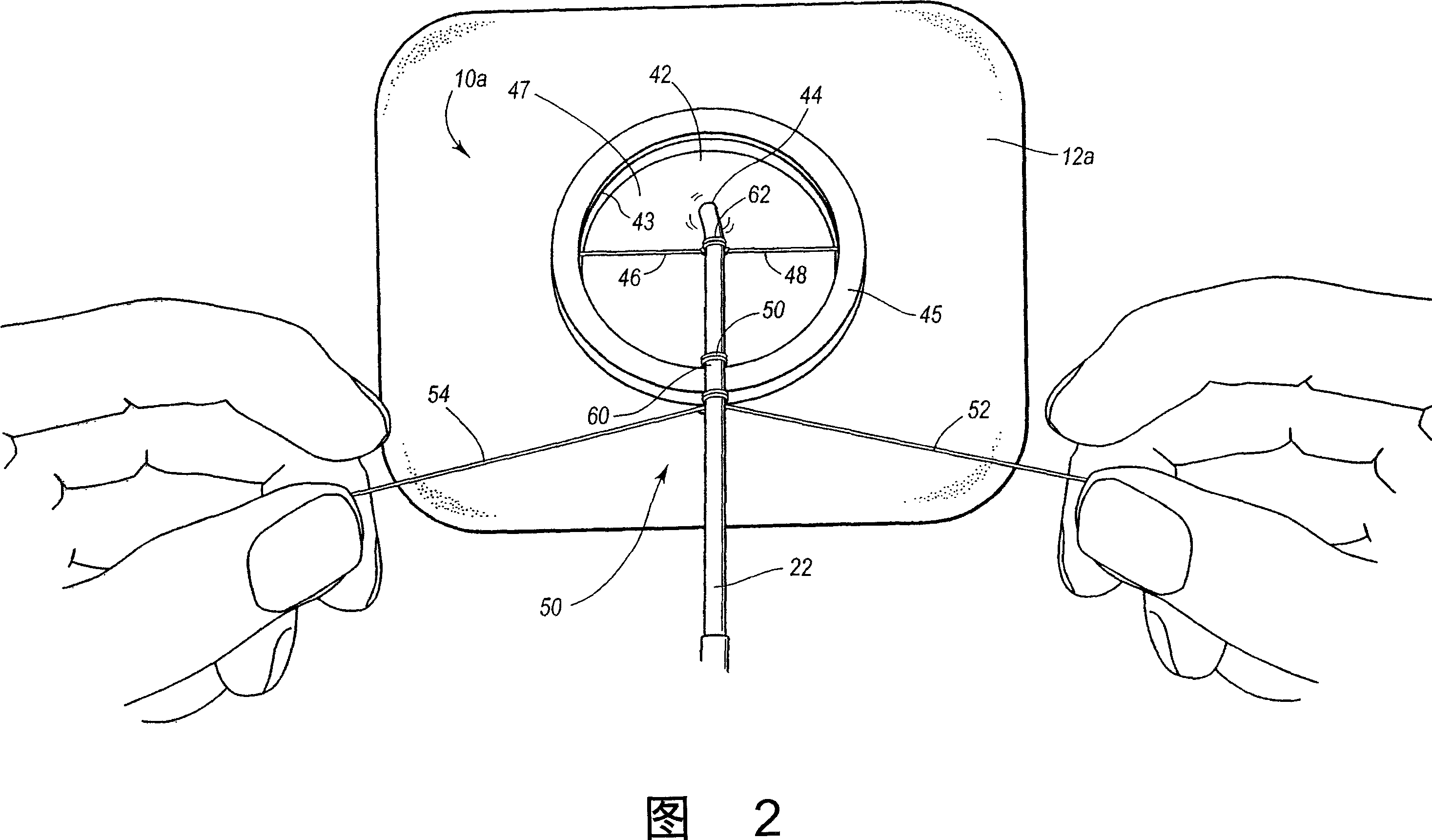 Self-suturing anchor device for a catheter