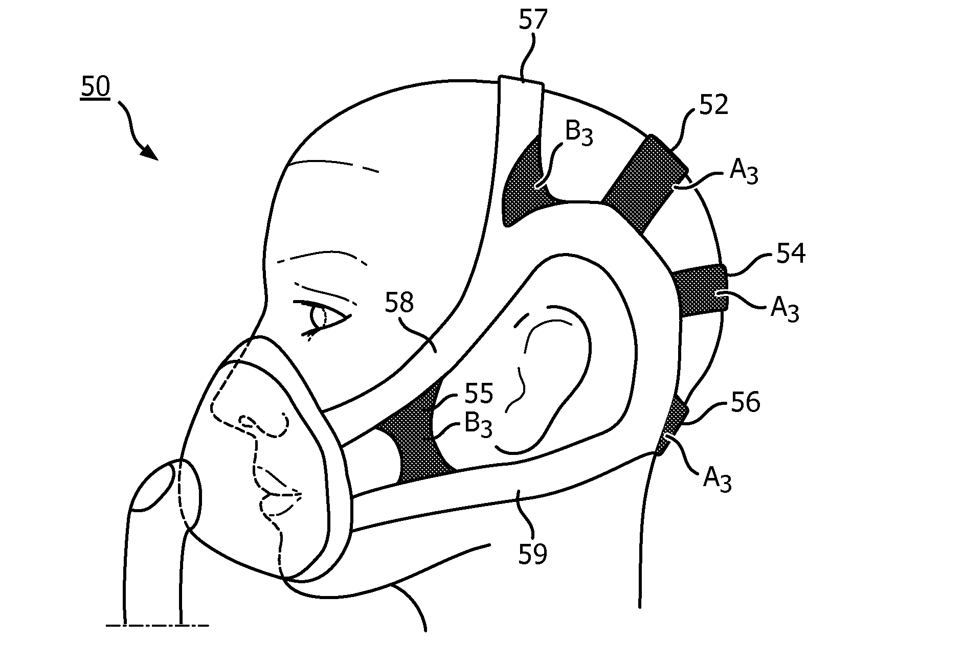 Multiple-material, single-plane-headgear