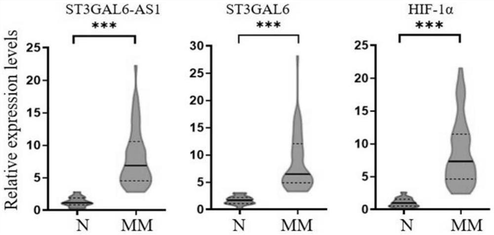 Application of ST3GAL6-AS1 gene, specific primer pair and kit