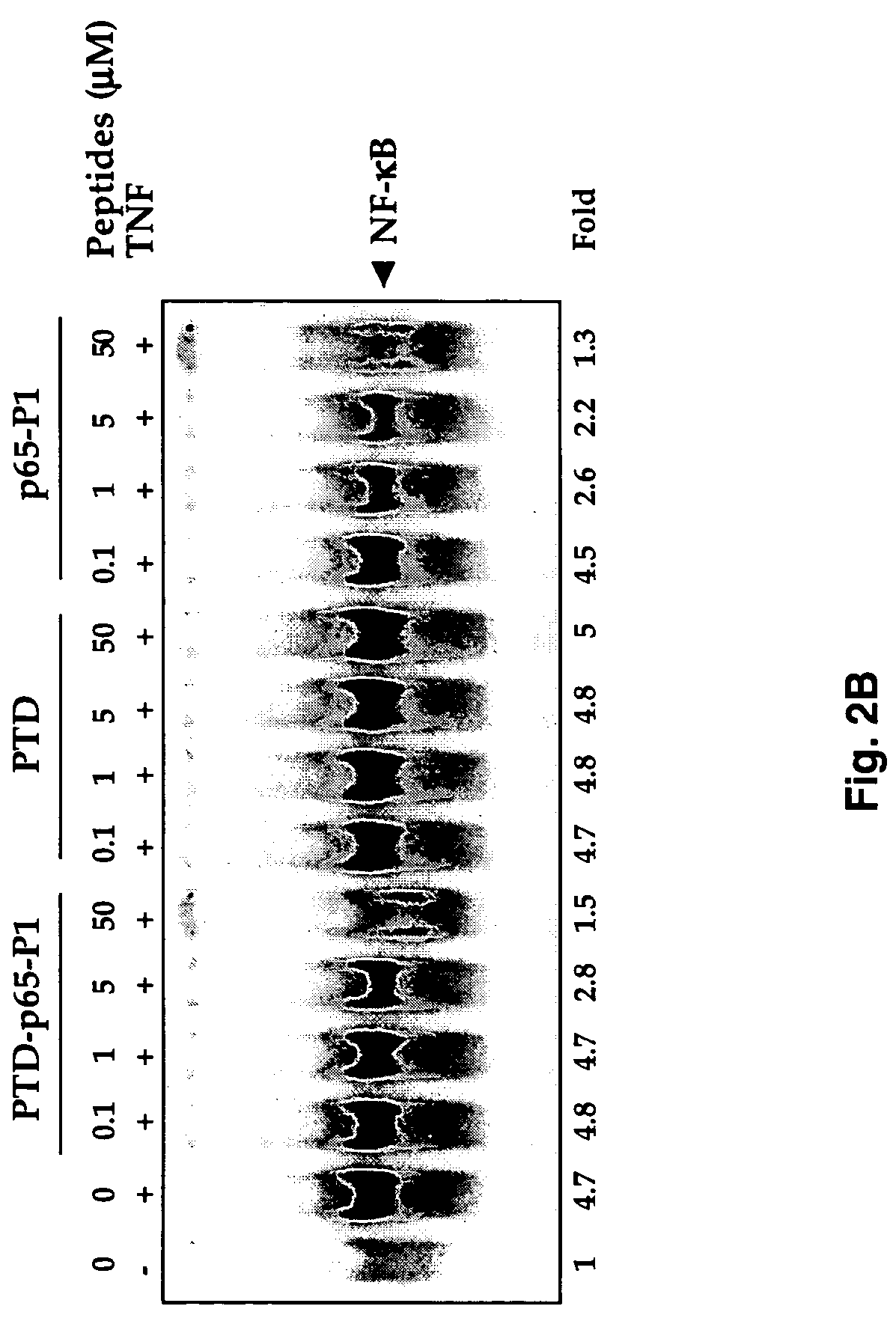 Selective inhibitors of nuclear factor-kappaB activation and uses thereof