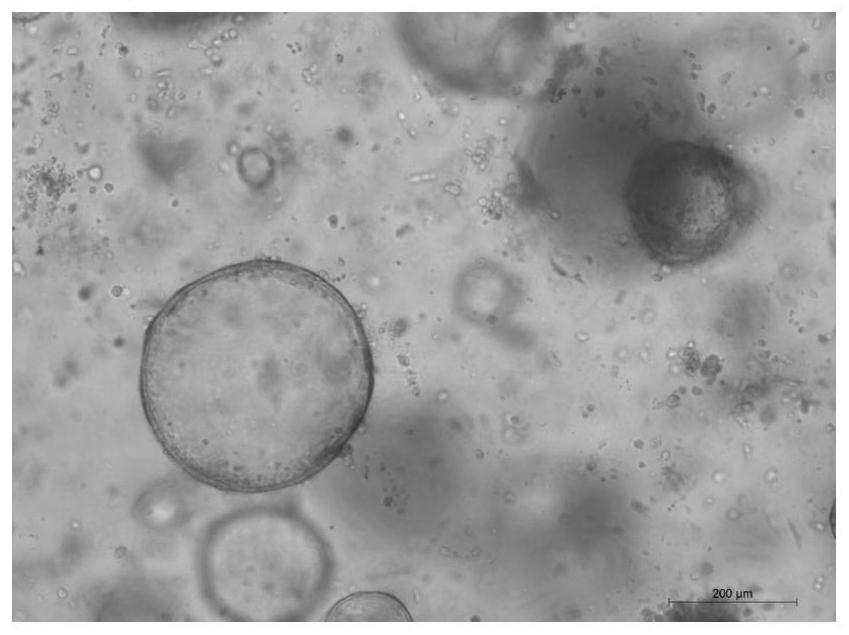 Three-dimensional culture method for in-vitro endometrial gland organs