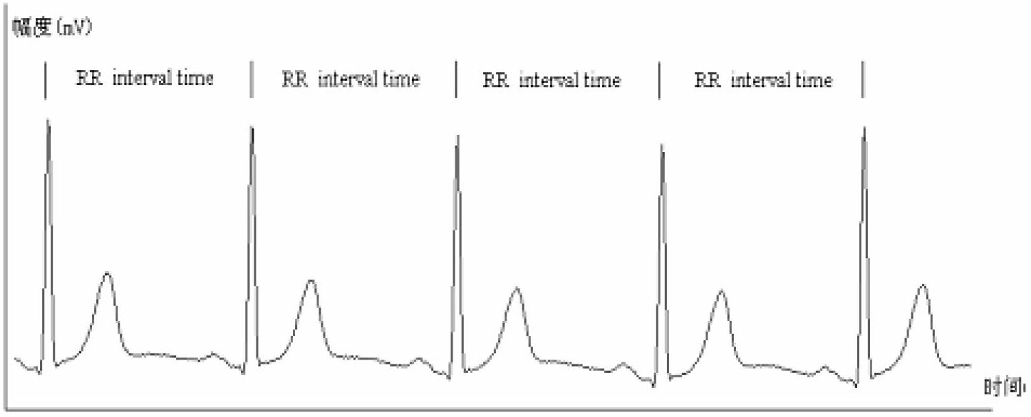 Heart rate variability nonlinear characteristic-based automatic diagnosis method for congestive heart failure