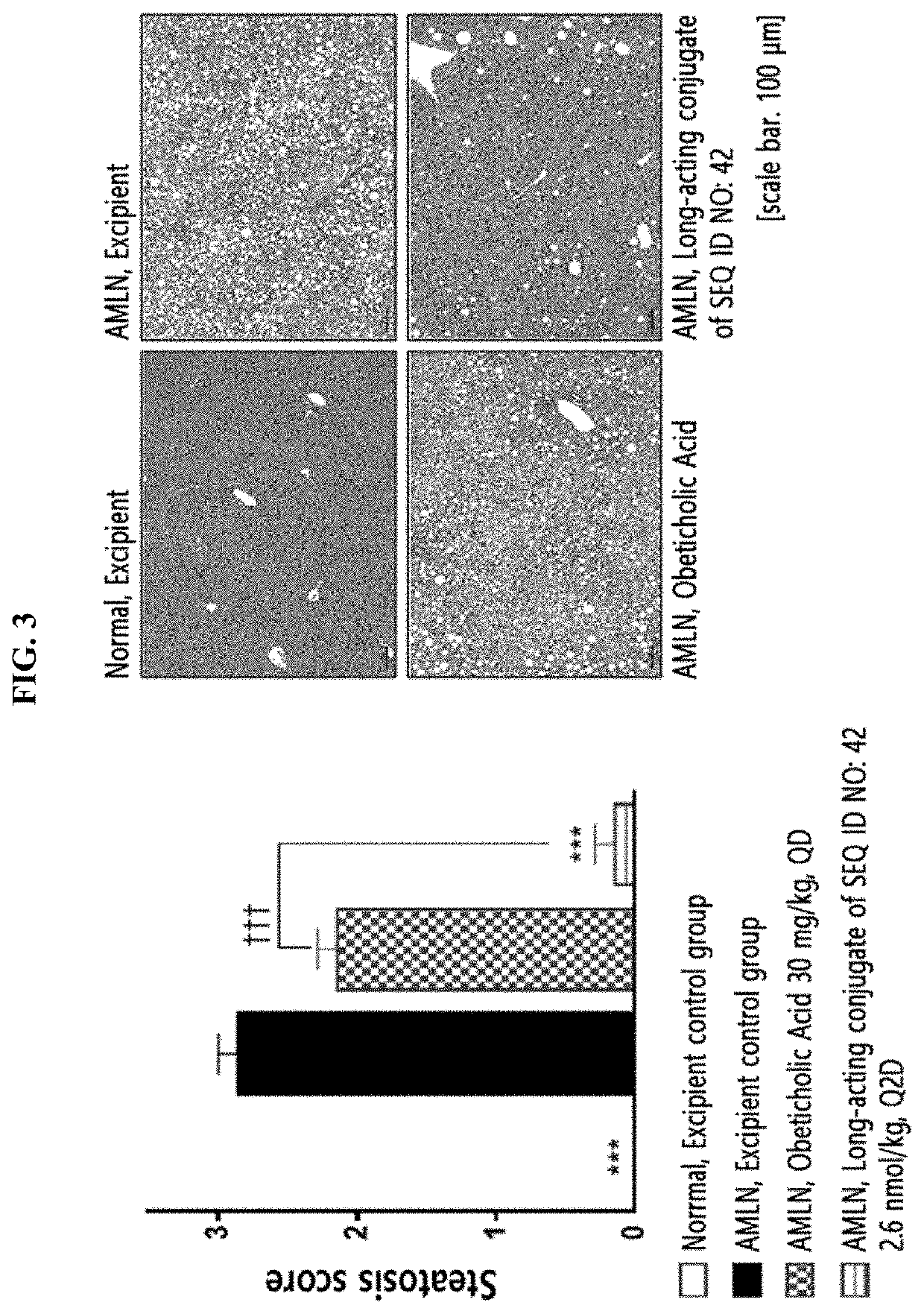 Therapeutic use of trigonal glucagon/glp-1/gip receptor agonist or conjugate thereof for liver disease