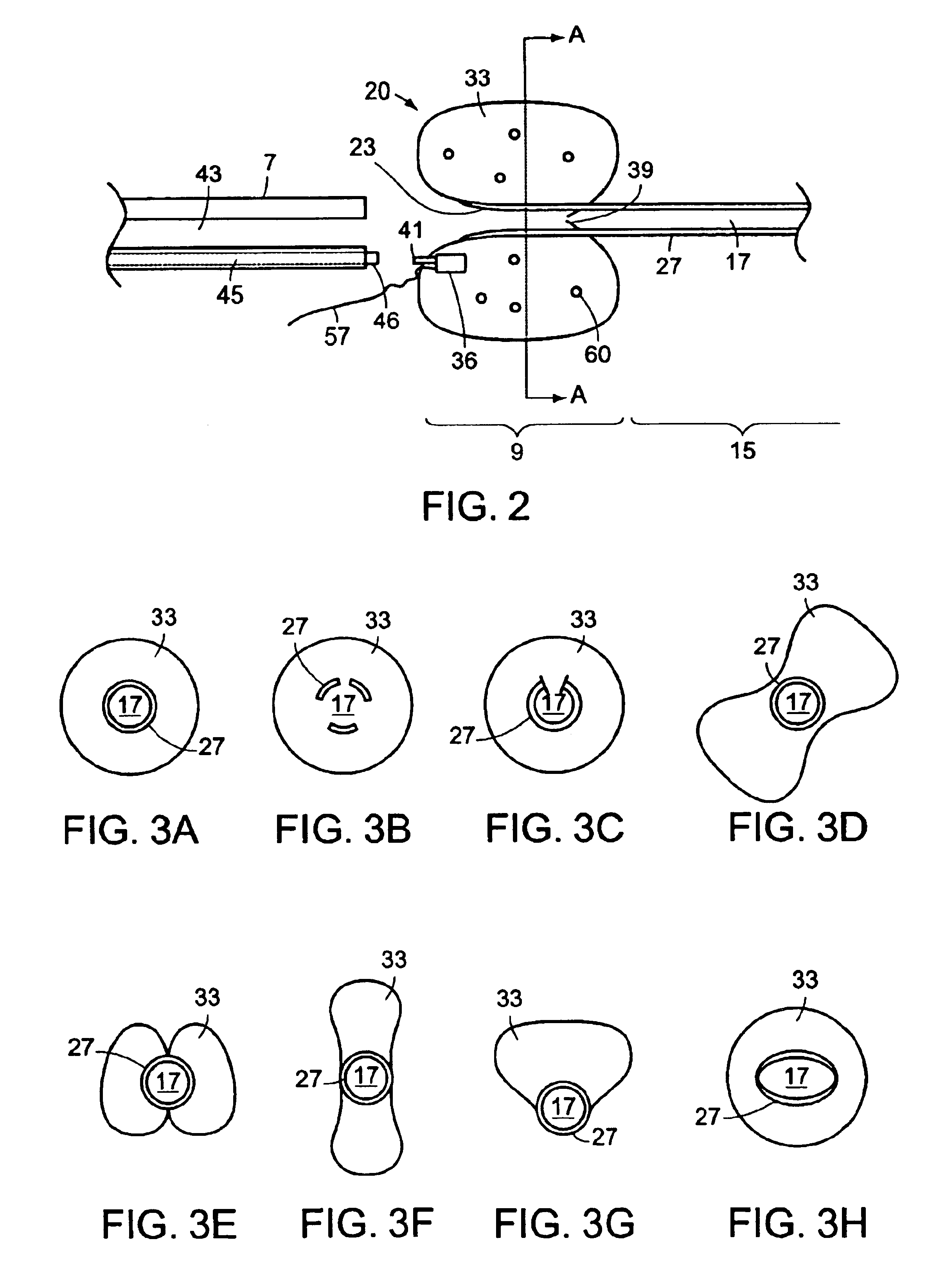 Ureteral stent with end-effector and related methods