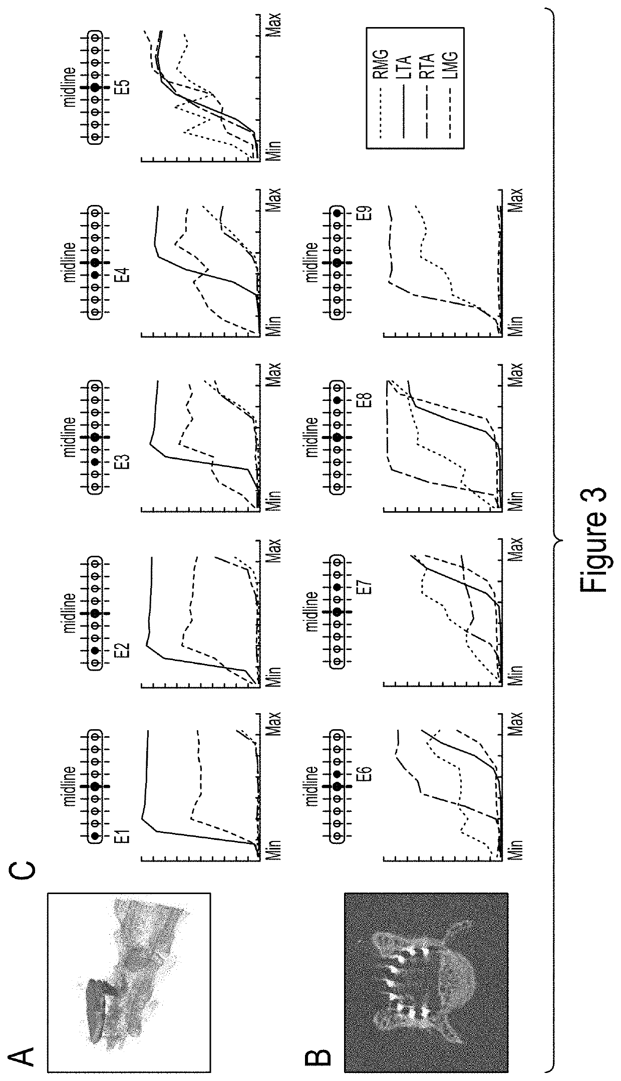 System for selective spatiotemporal stimulation of the spinal cord