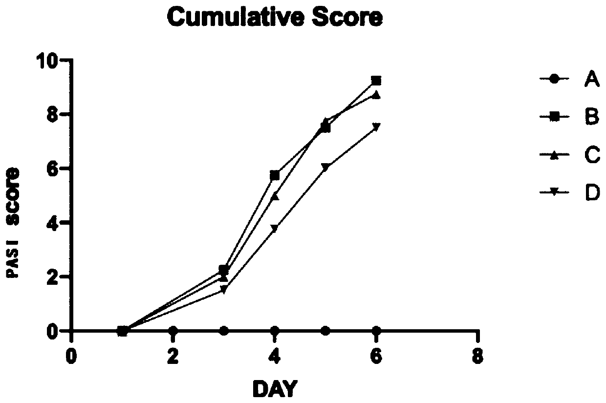 Application of decenotinib in preparation of externally applied medicine for treating psoriasis, medicine and preparation method of medicine