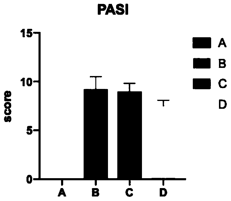 Application of decenotinib in preparation of externally applied medicine for treating psoriasis, medicine and preparation method of medicine