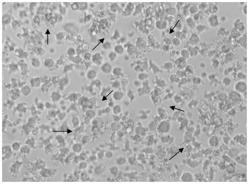 dc-cik co-cultured cells and its preparation method, sensitizing antigen and application