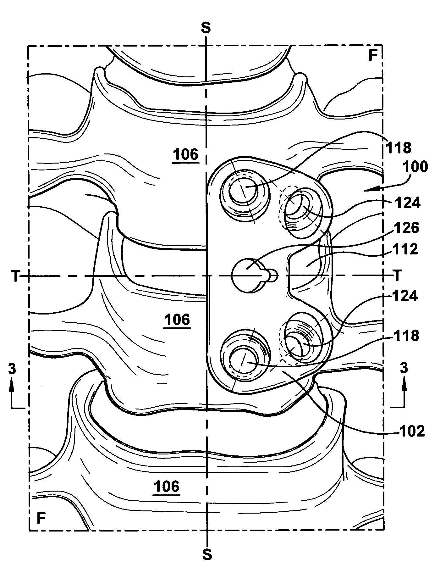 Cervical fusion apparatus and method for use
