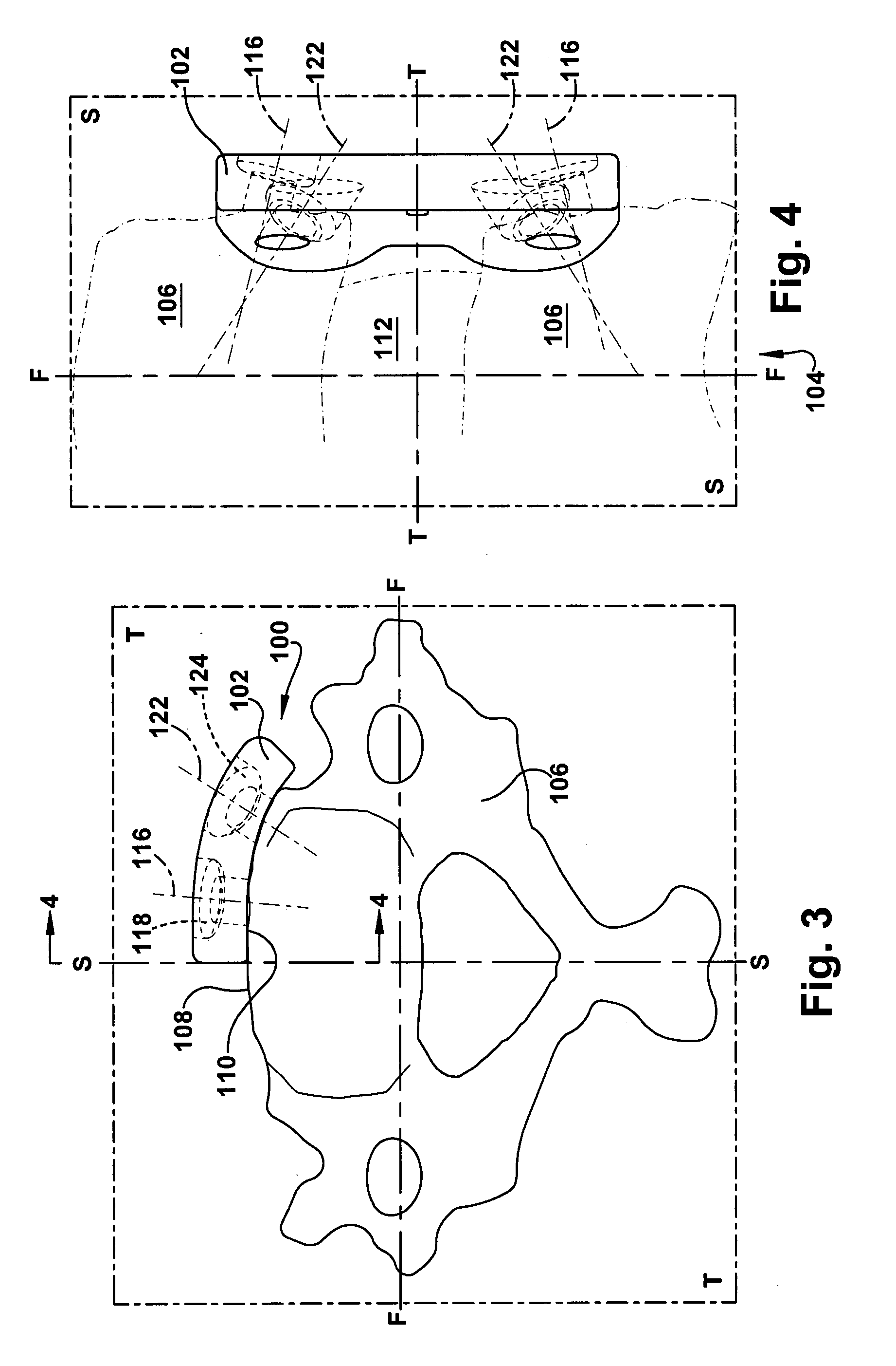 Cervical fusion apparatus and method for use