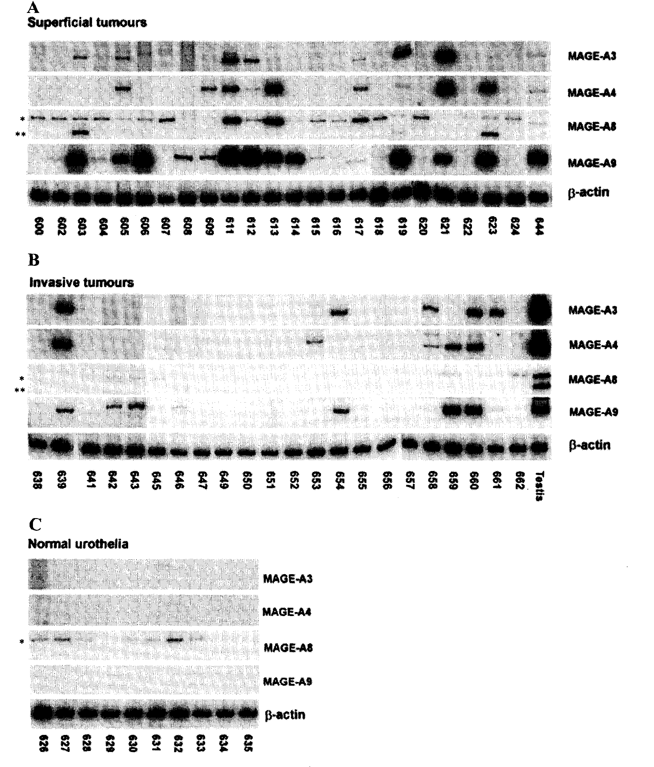 Cancer Antigen Mage-A9 and Uses Thereof