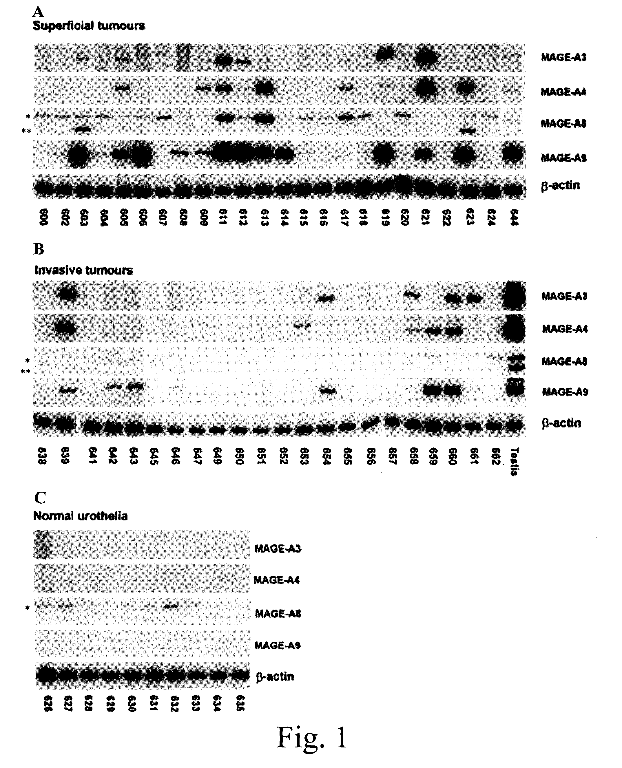 Cancer Antigen Mage-A9 and Uses Thereof