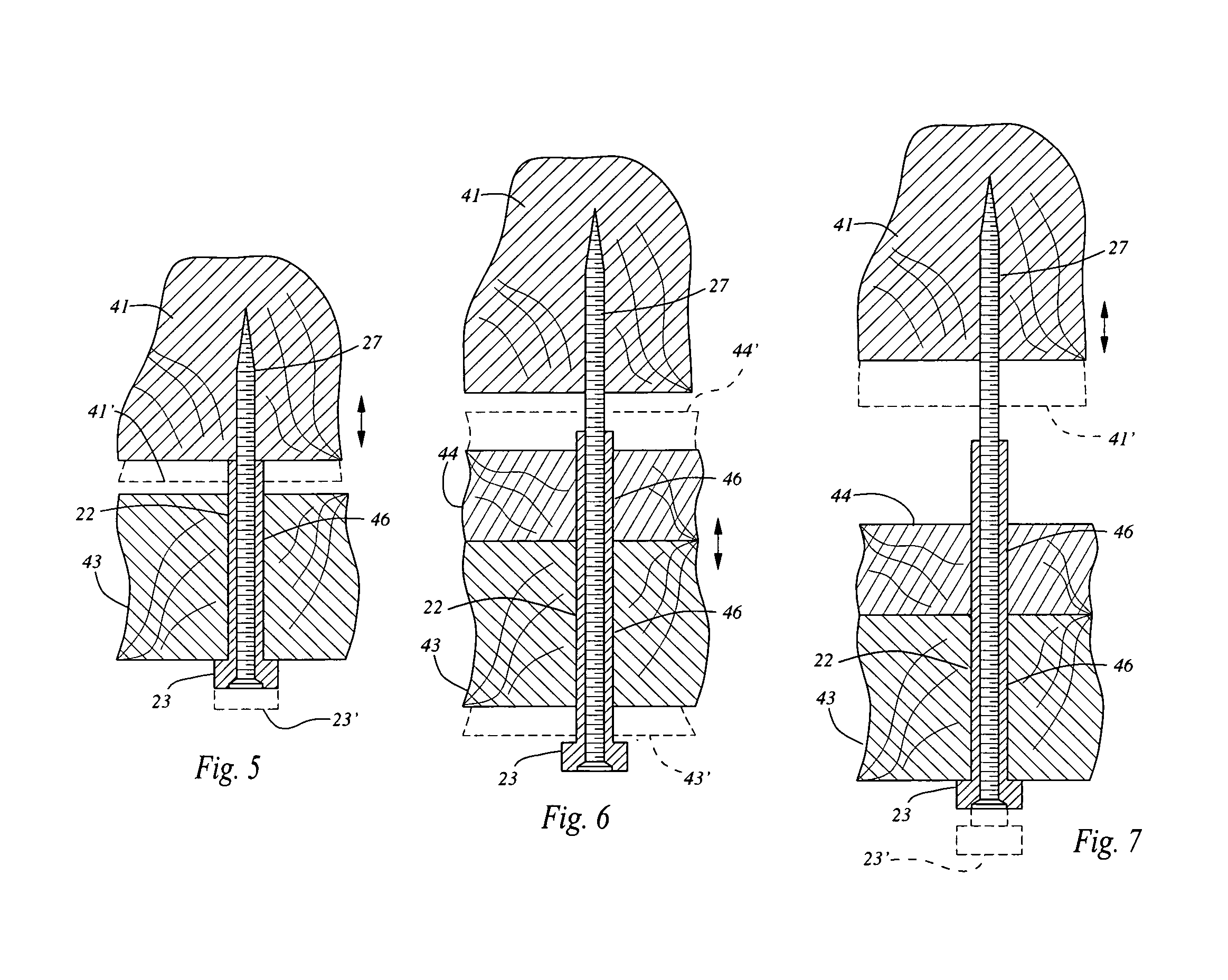 Method and apparatus for securing non-load bearing walls