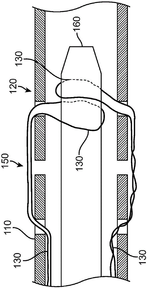 Systems and methods for coupling and decoupling a catheter