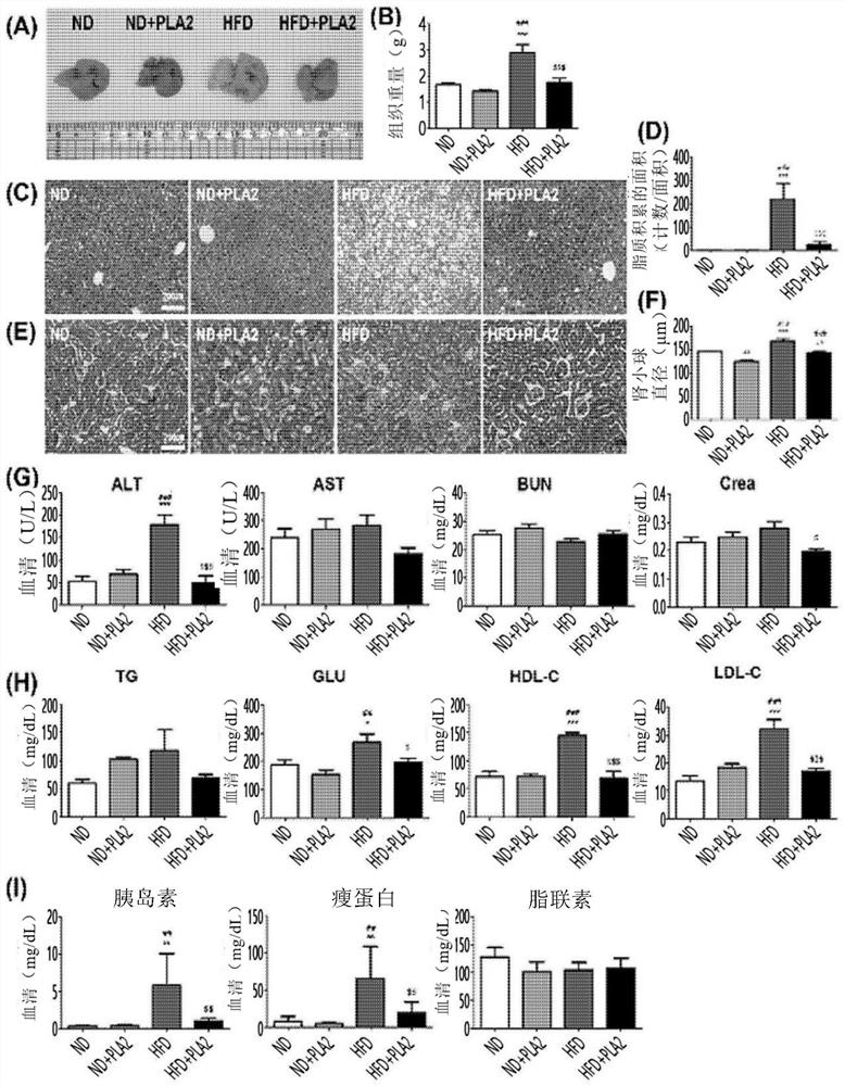 Composition for preventing or treating obesity comprising phospholipase A2 as active ingredient