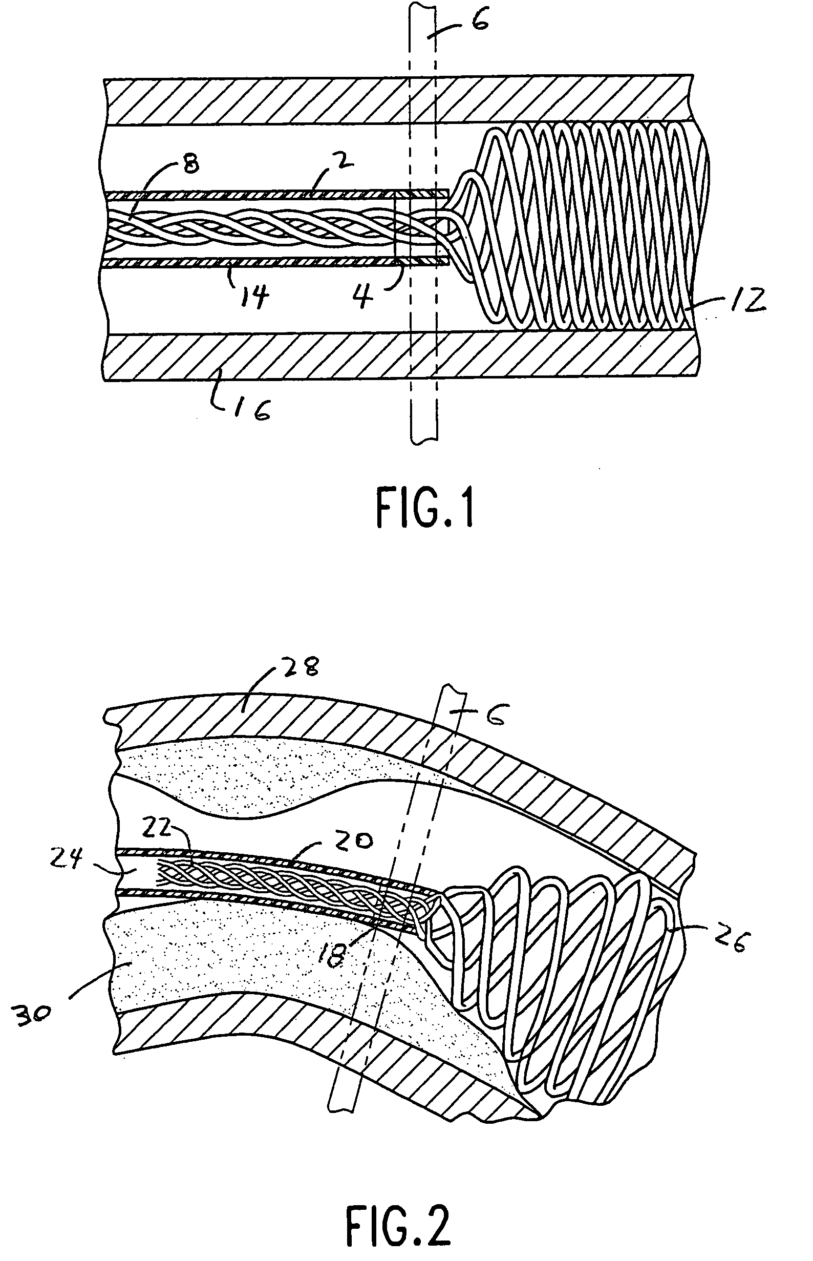 Thermal transition methods and devices