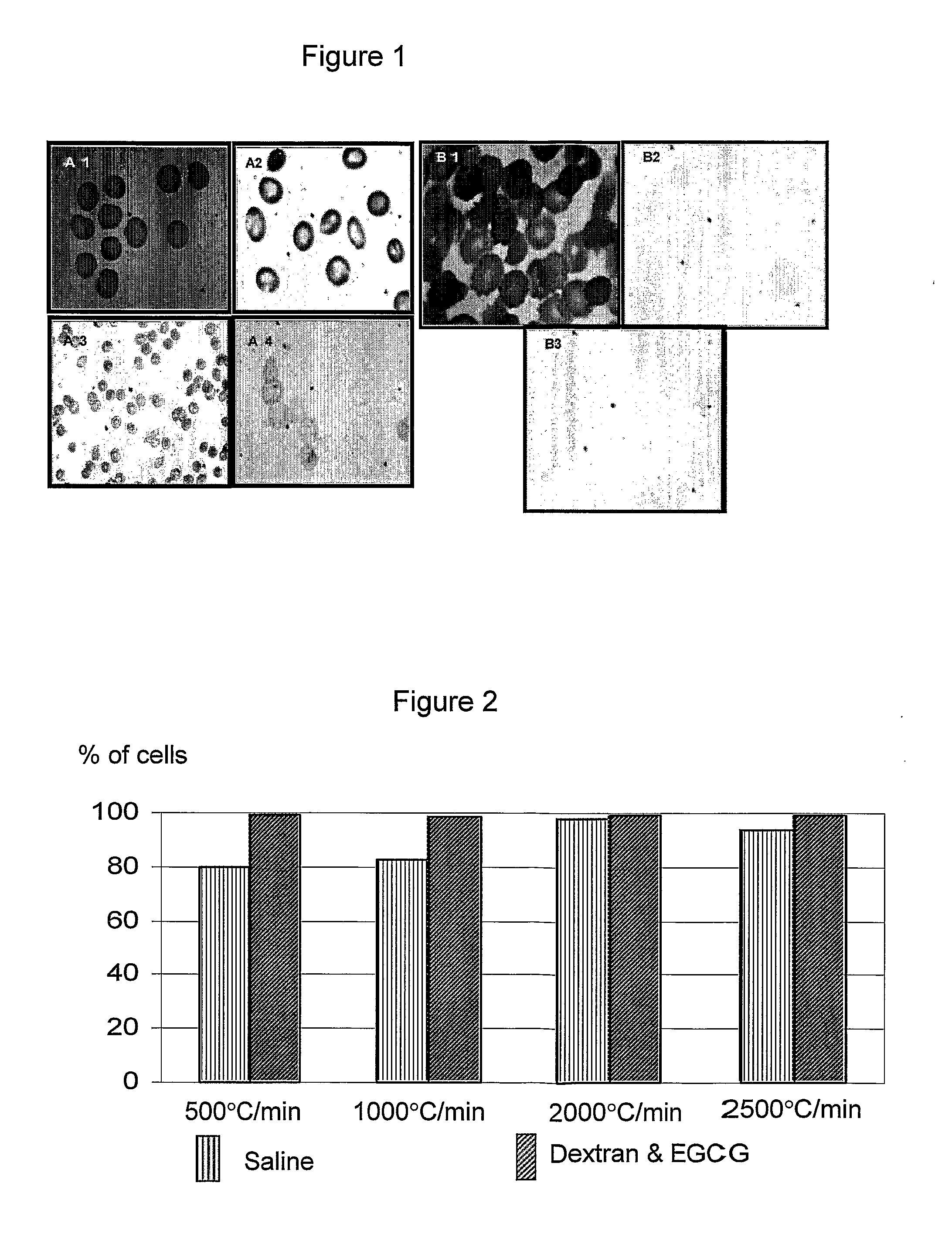 Biological material and methods and solutions for preservation thereof
