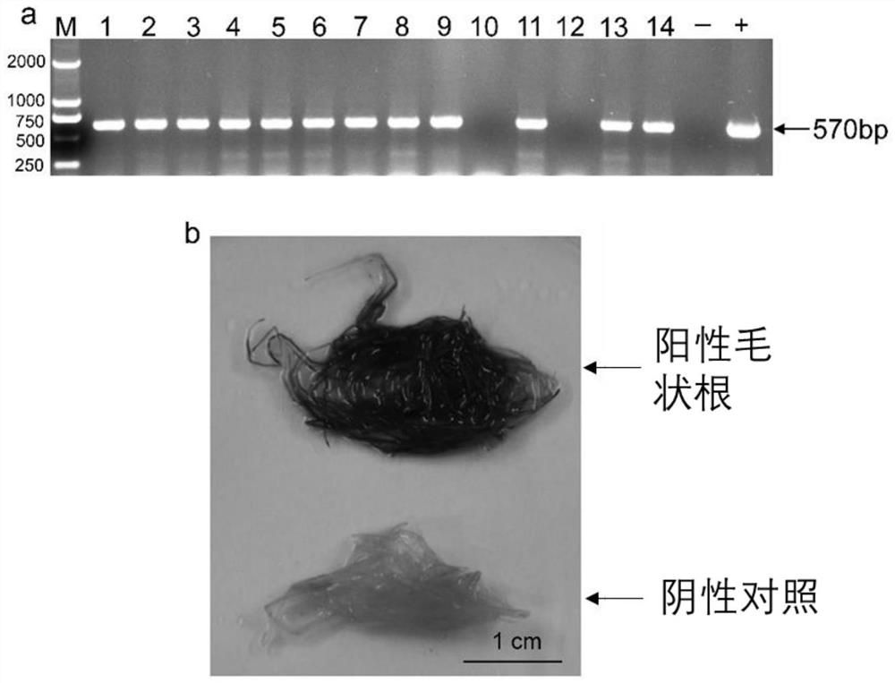 Establishment method of tobacco hairy root genetic transformation system