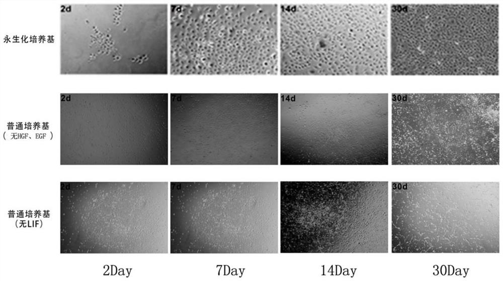 Liver oval cell immortalization culture medium as well as preparation method and application thereof