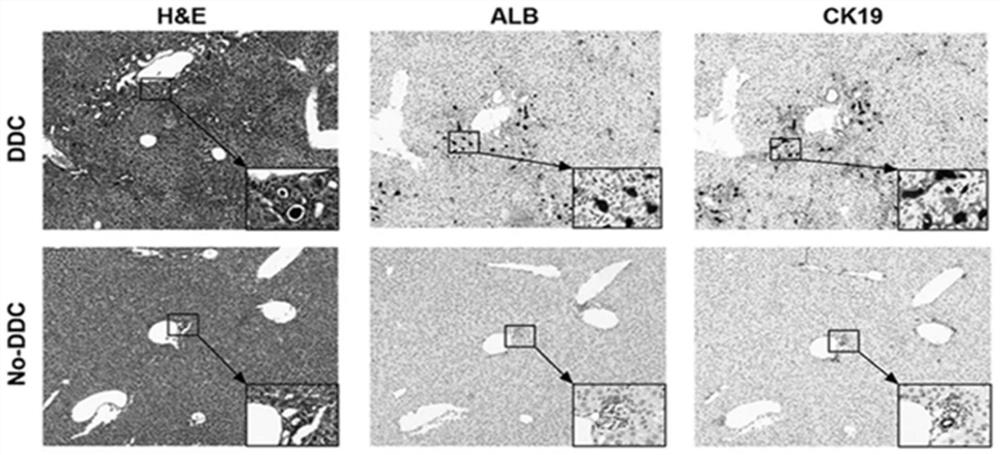 Liver oval cell immortalization culture medium as well as preparation method and application thereof