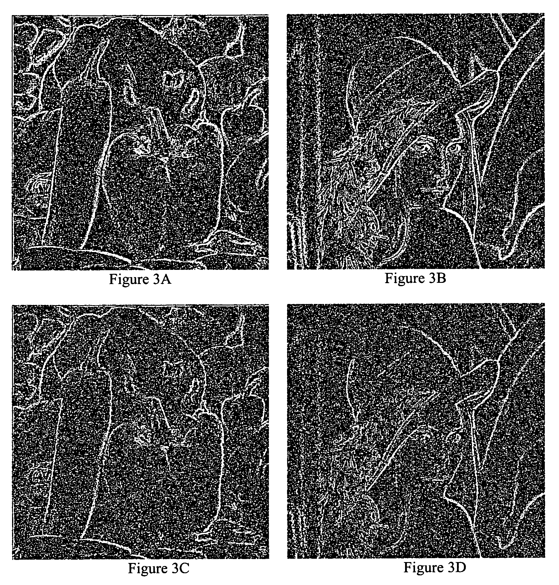 Image denoising based on wavelets and multifractals for singularity detection and multiscale anisotropic diffusion