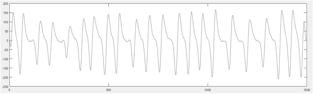 Noise detection method and device