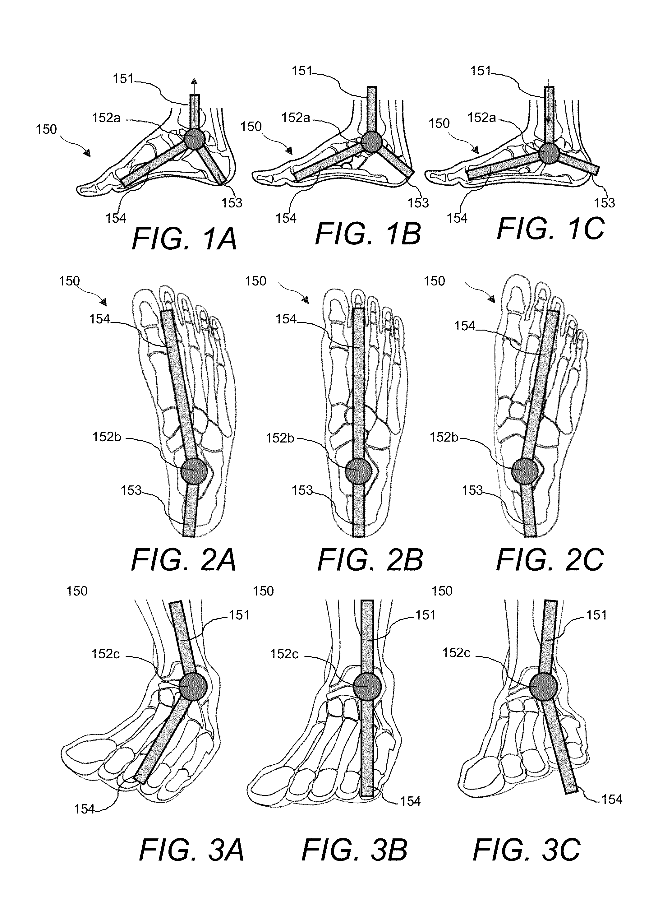 Article of Footwear with Embedded Orthotic Devices