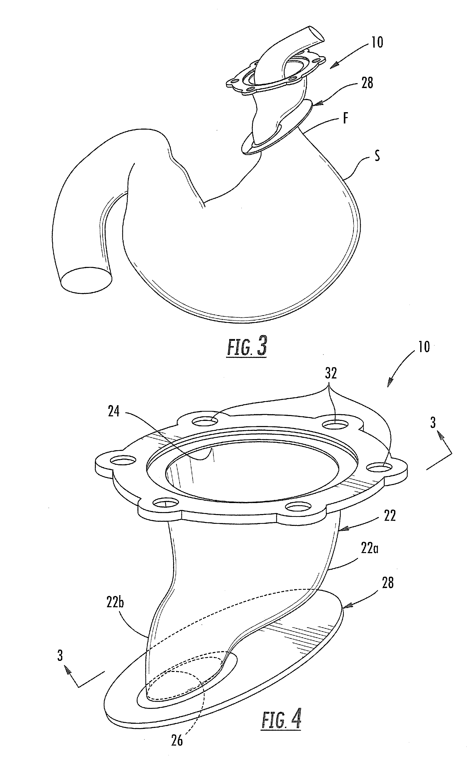 Devices for treating gastroesophageal reflux disease and hiatal hernia, and methods of treating gastroesophageal reflux disease and hiatal hernia using same