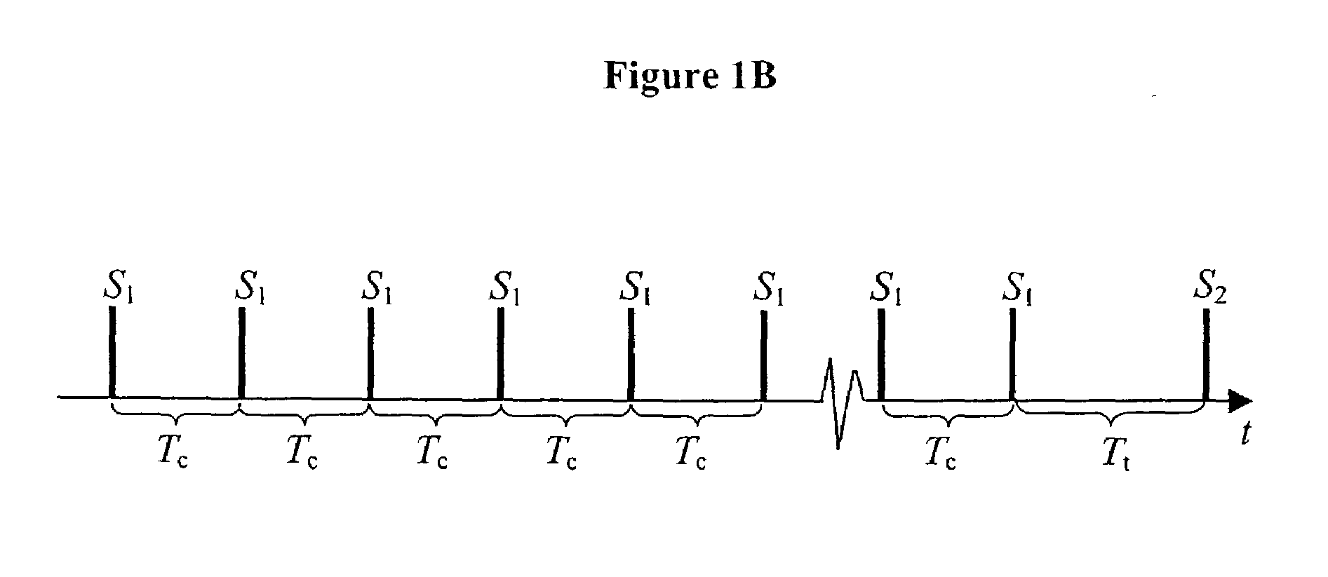 Method and system for evaluating arrhythmia risk with QT-RR interval data sets