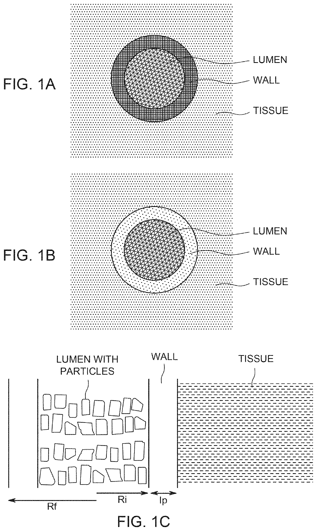 Implants and constructs including hollow fibers