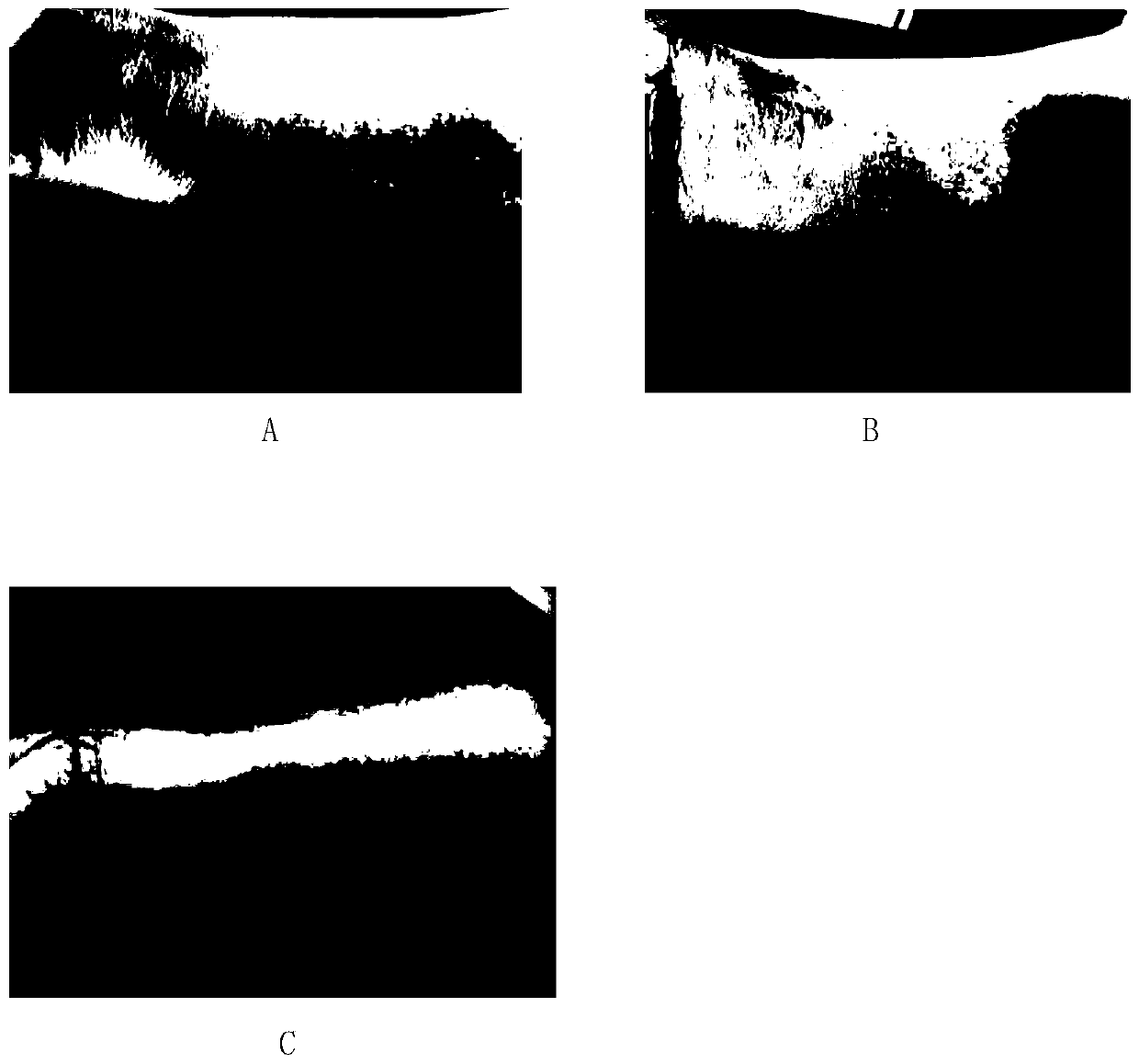 Silicone gel capable of concealing blemishes and treating scars and its preparation method