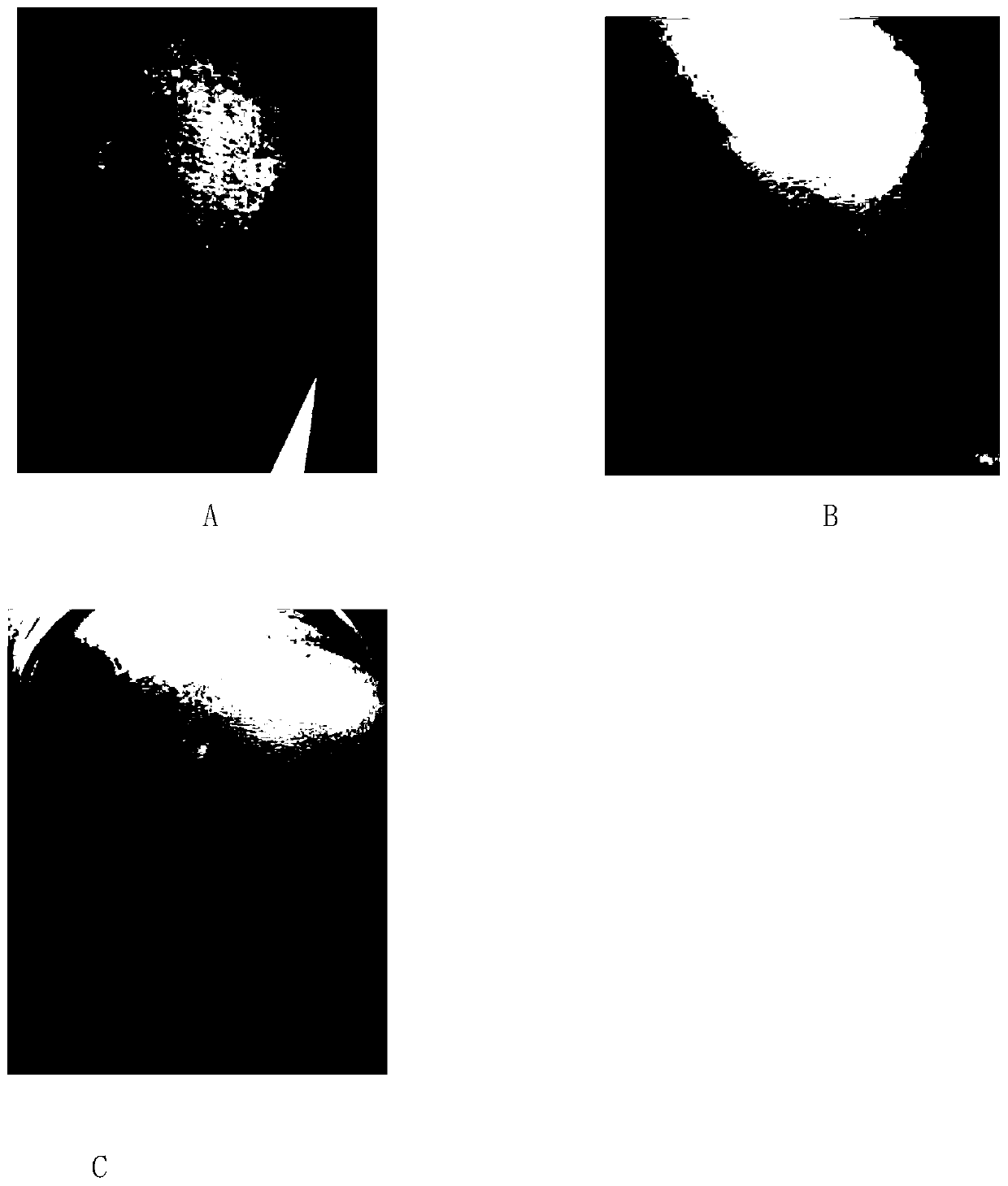 Silicone gel capable of concealing blemishes and treating scars and its preparation method