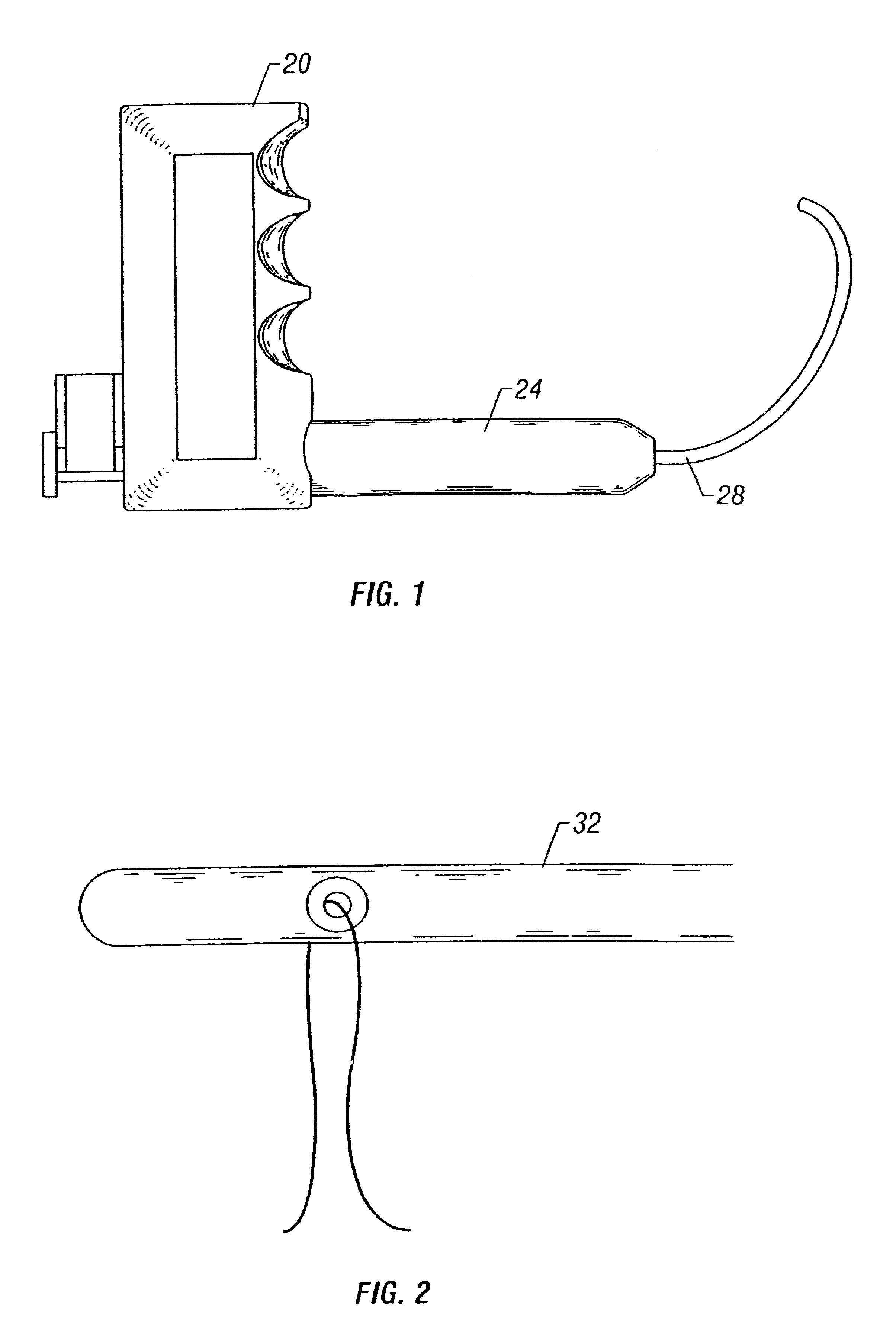 Method and apparatus for correction for gynecological pathologies including treatment of female cystocele