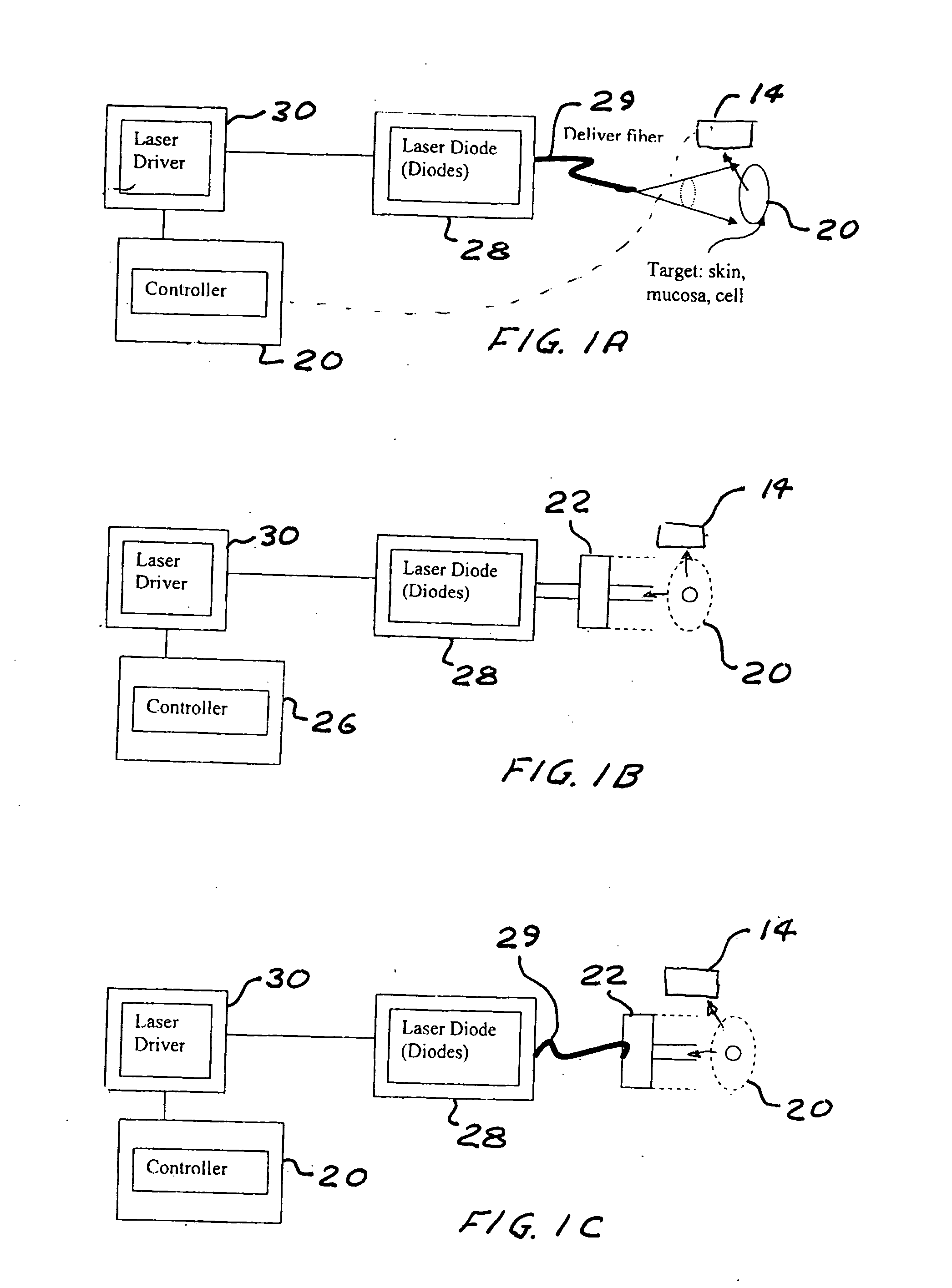 Portable laser and process for producing controlled pain