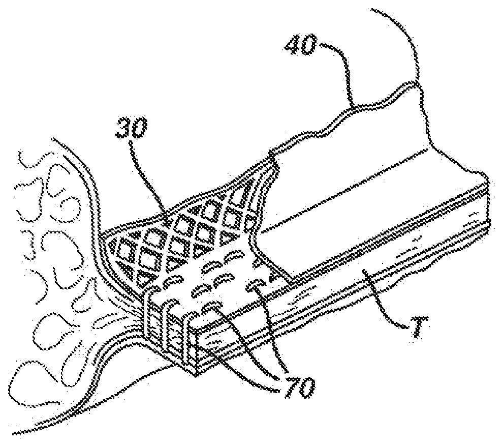 Device for sealing staples in tissue