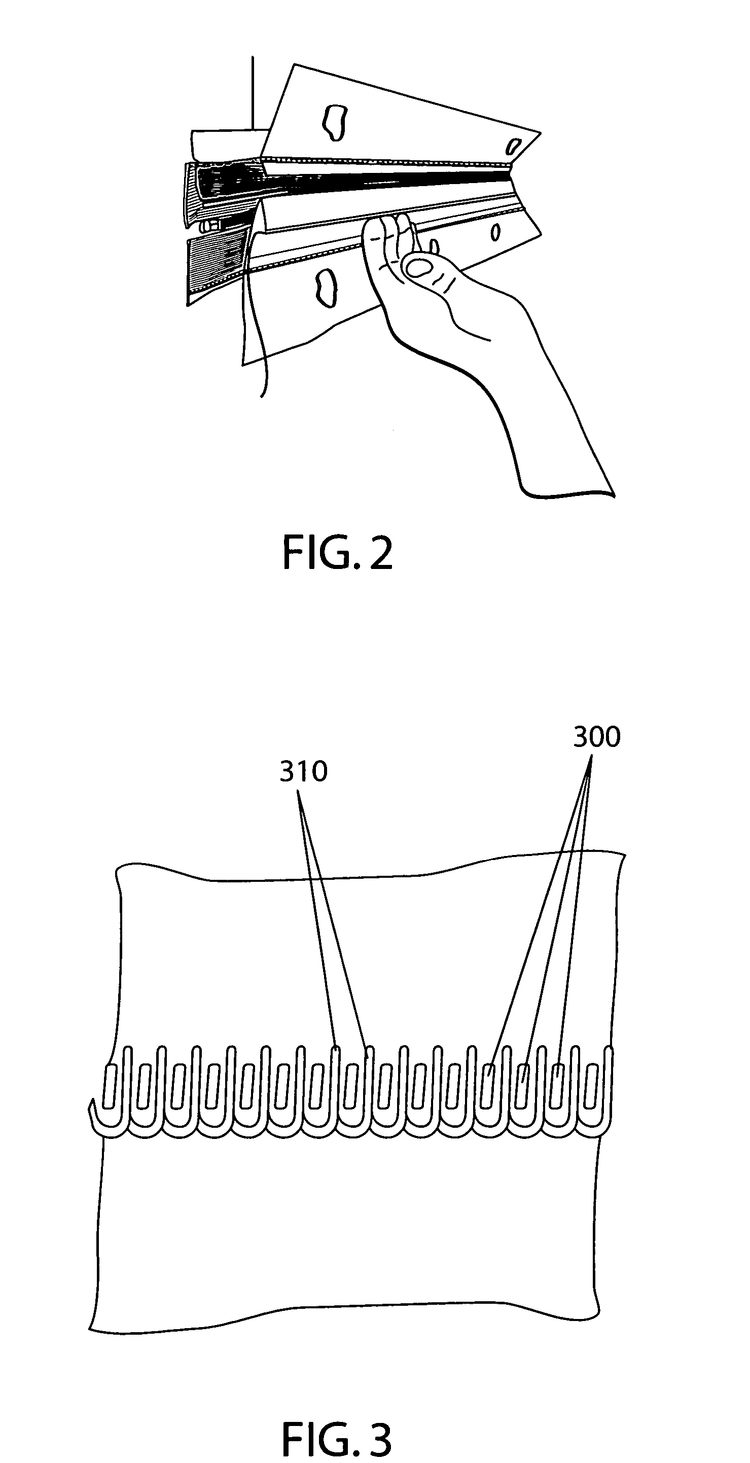 Method and device for stabilizing unseamed loops