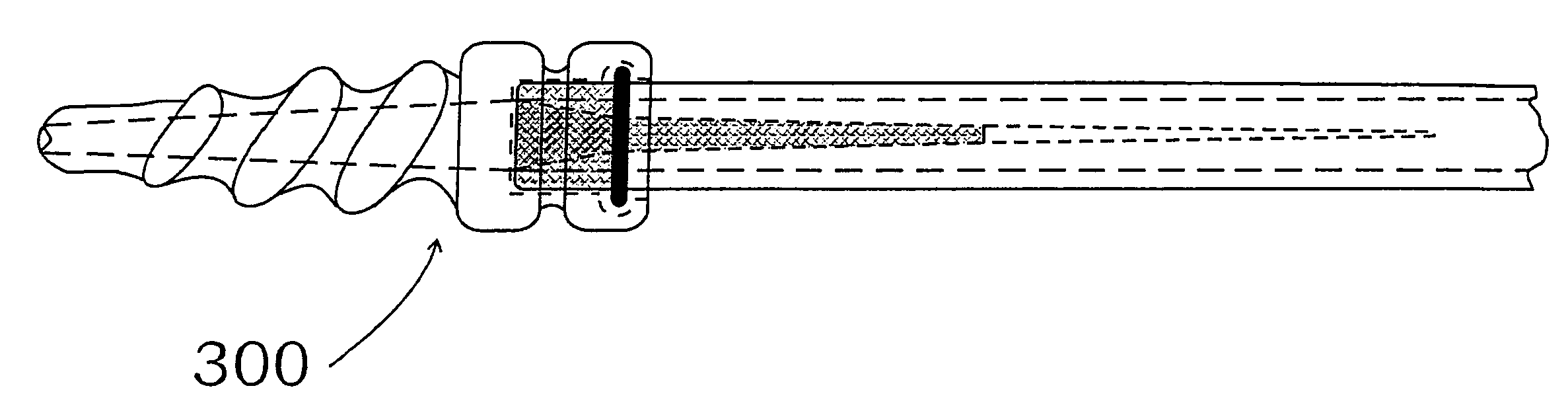 Method and apparatus for creating a pathway in an animal