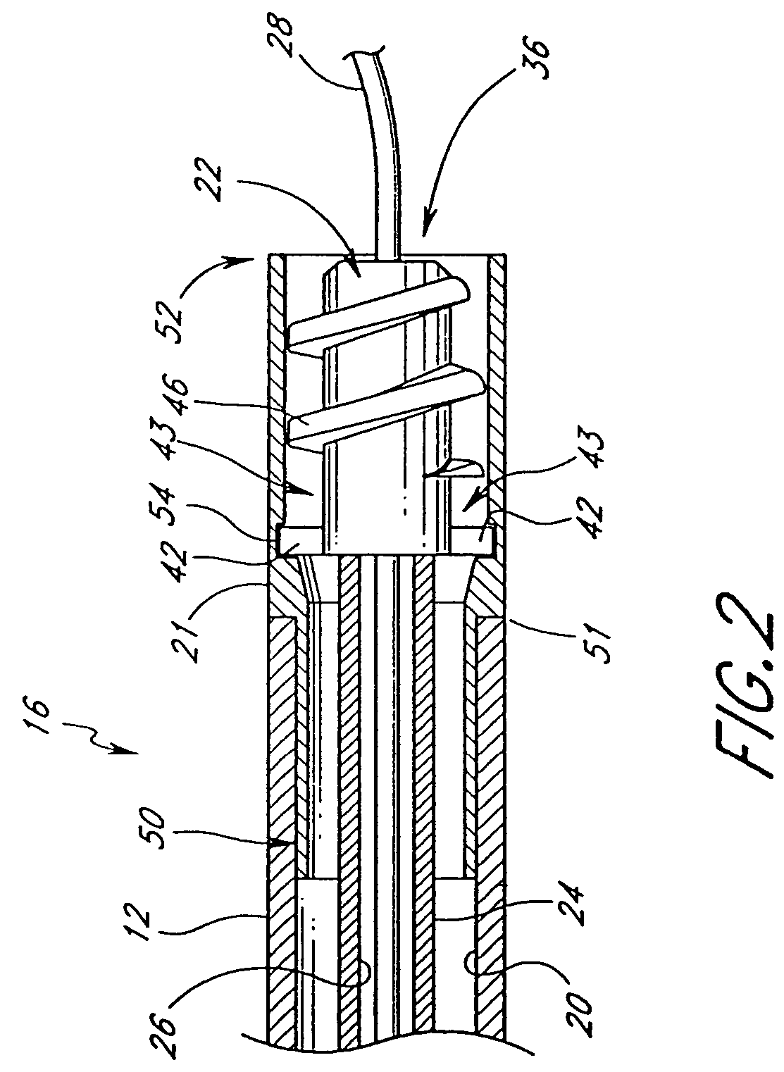 Rotational atherectomy system with stationary cutting elements