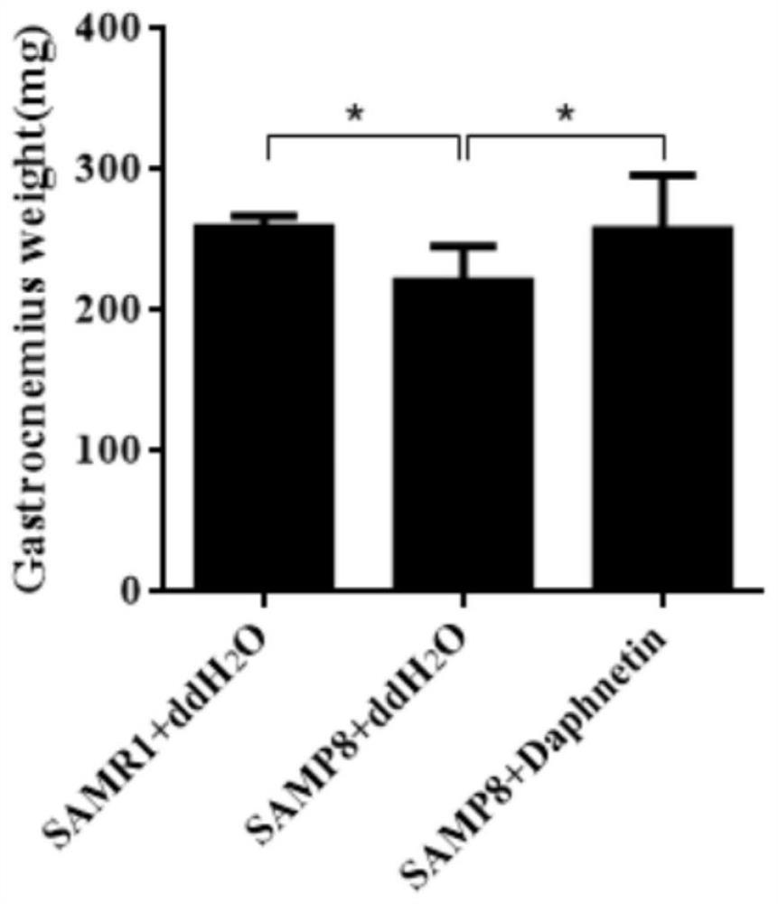 Application of daphnetin in preparation of medicine for preventing and/or treating muscular atrophy, sarcopenia and exercise capacity decline caused by age increase