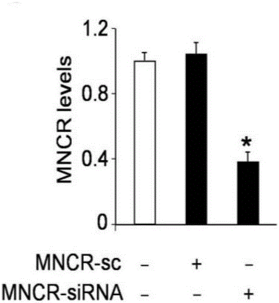 CircRNA MNCR nucleotide, circRNA MNCR nucleotide containing pharmaceutical composition and application thereof