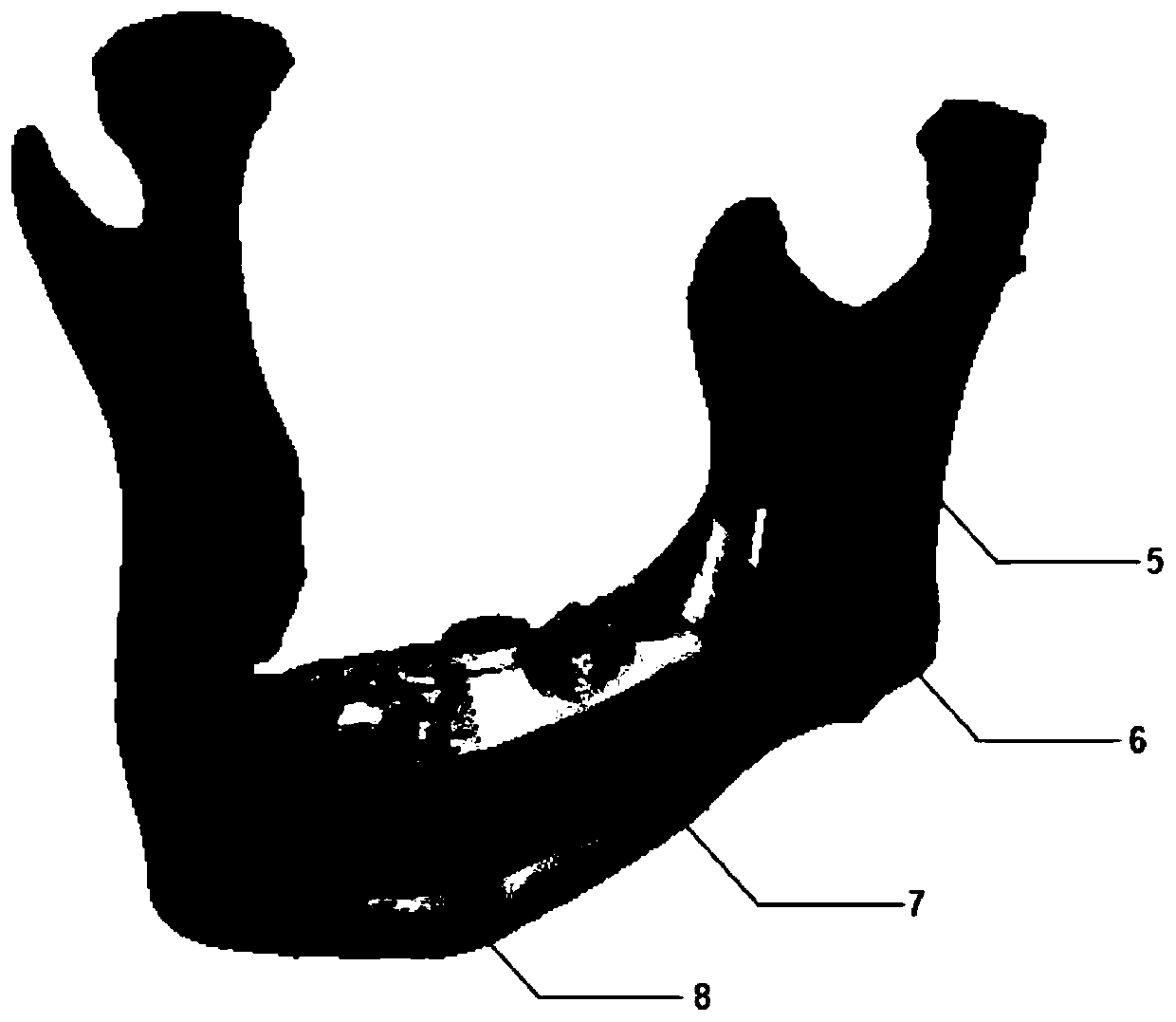 Mandibular position information recording device based on guide plate