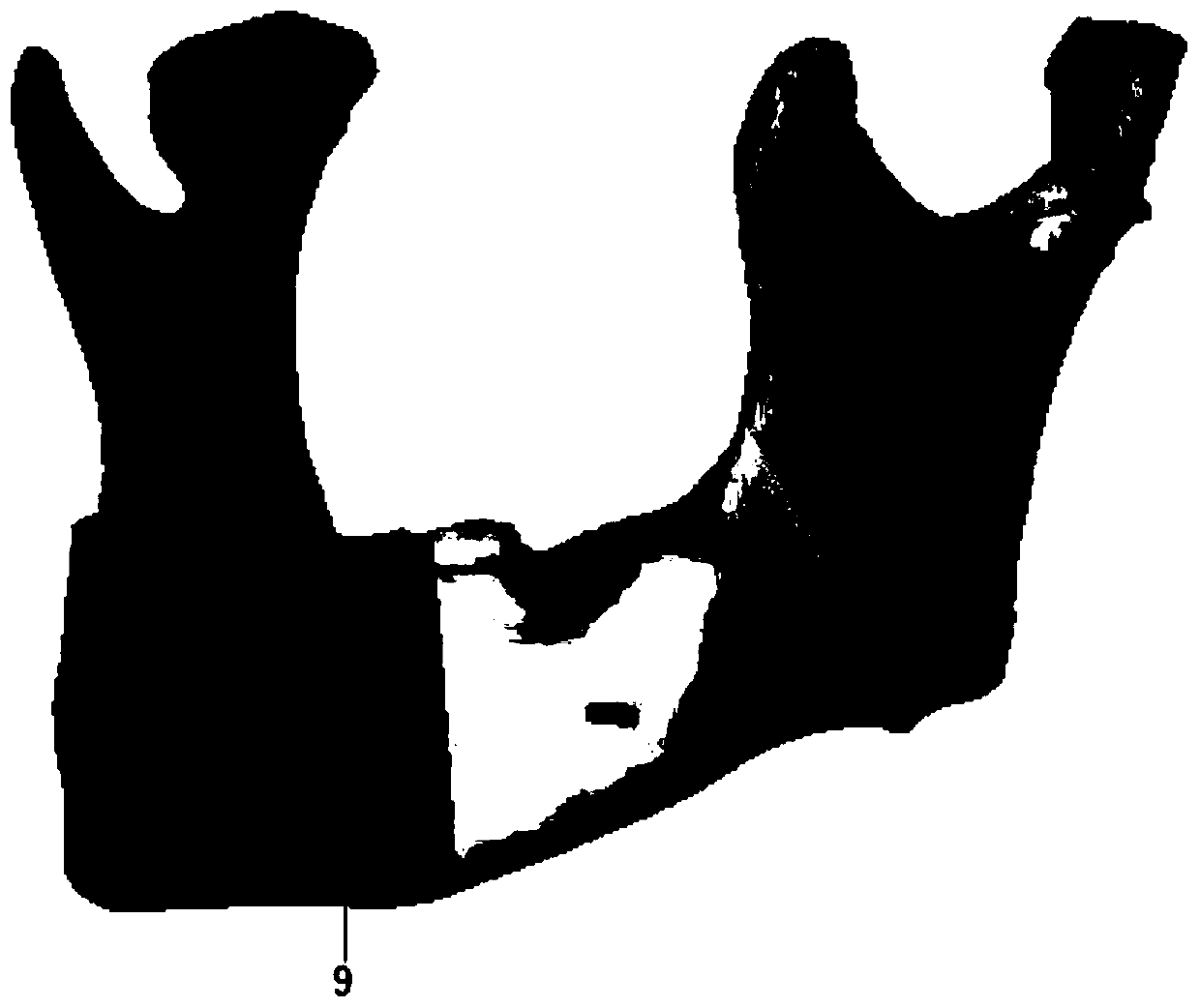 Mandibular position information recording device based on guide plate